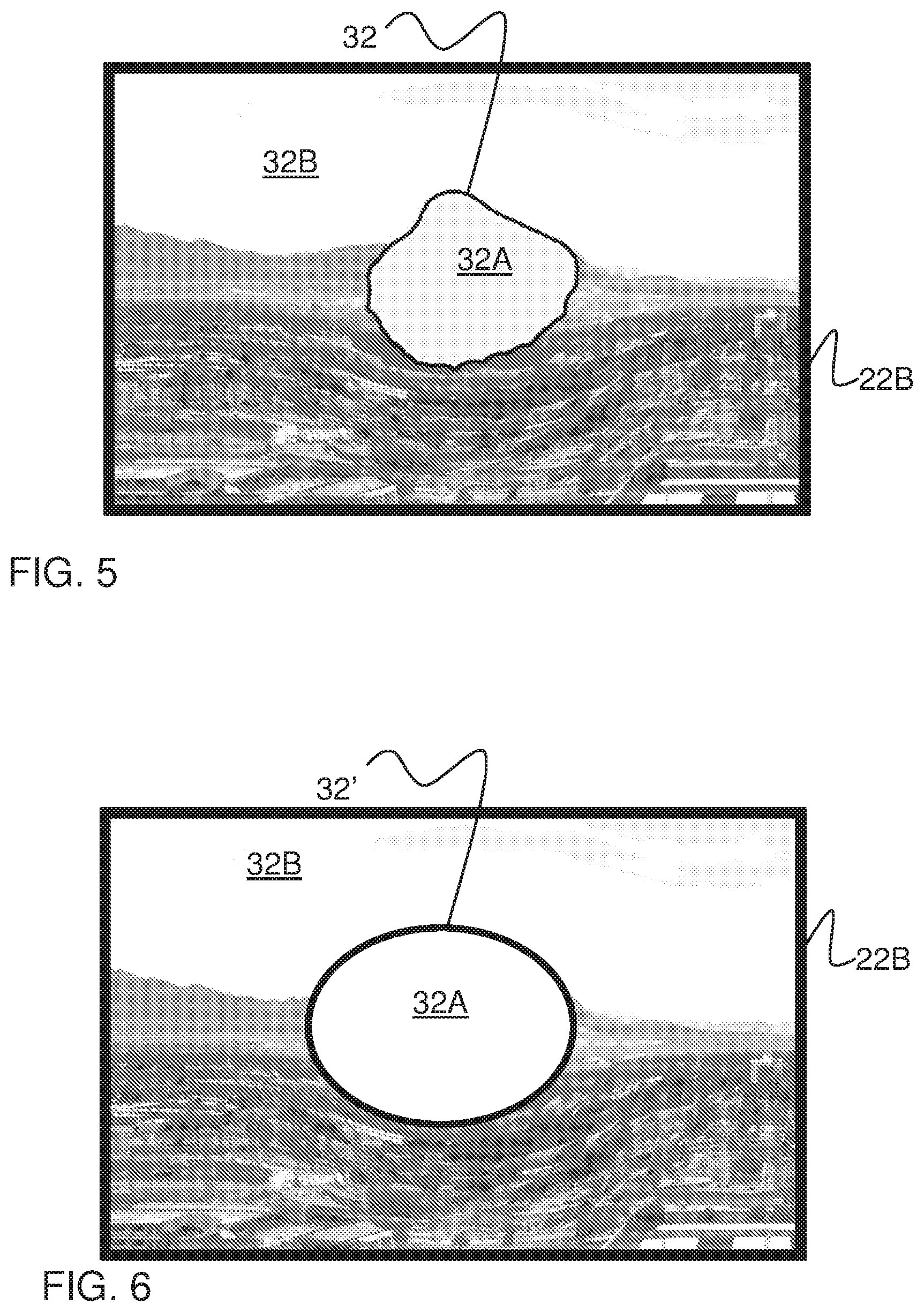 Patent US12137974 Figure 6 – System, method, and non-transitory computer-readable storage media related to correction of vision defects using a visual display