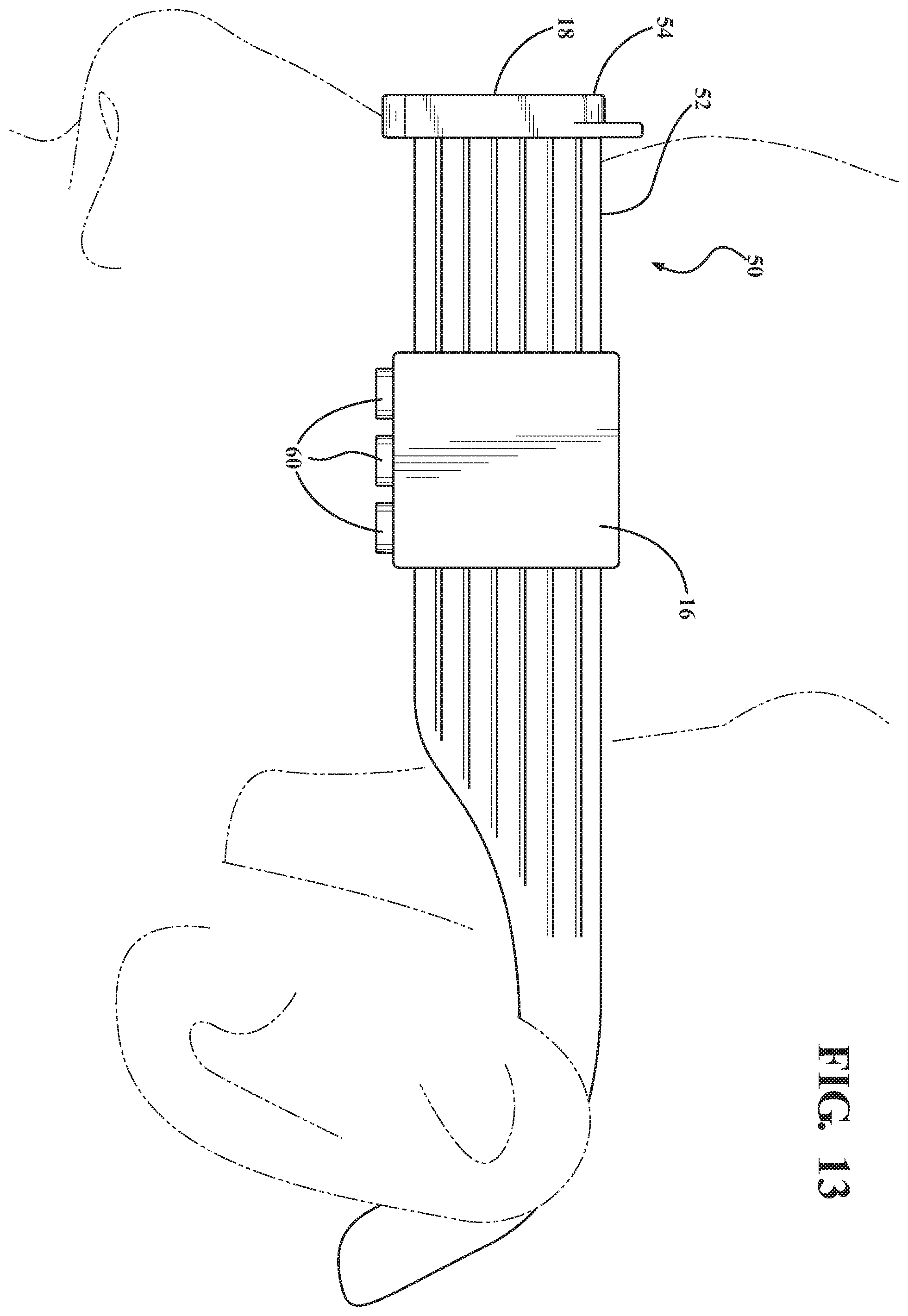 Patent US12137974 Figure 10 – System, method, and non-transitory computer-readable storage media related to correction of vision defects using a visual display