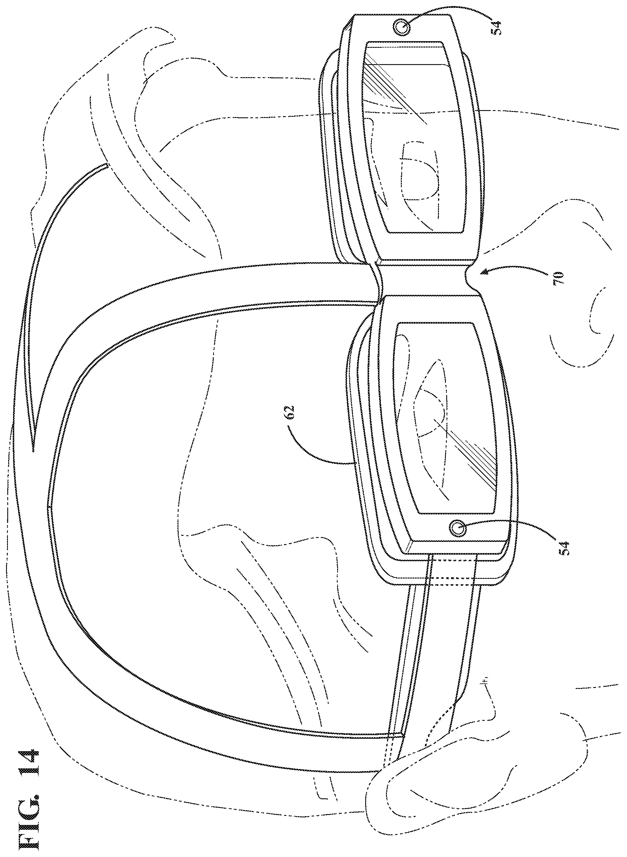 Patent US12137974 Figure 11 – System, method, and non-transitory computer-readable storage media related to correction of vision defects using a visual display