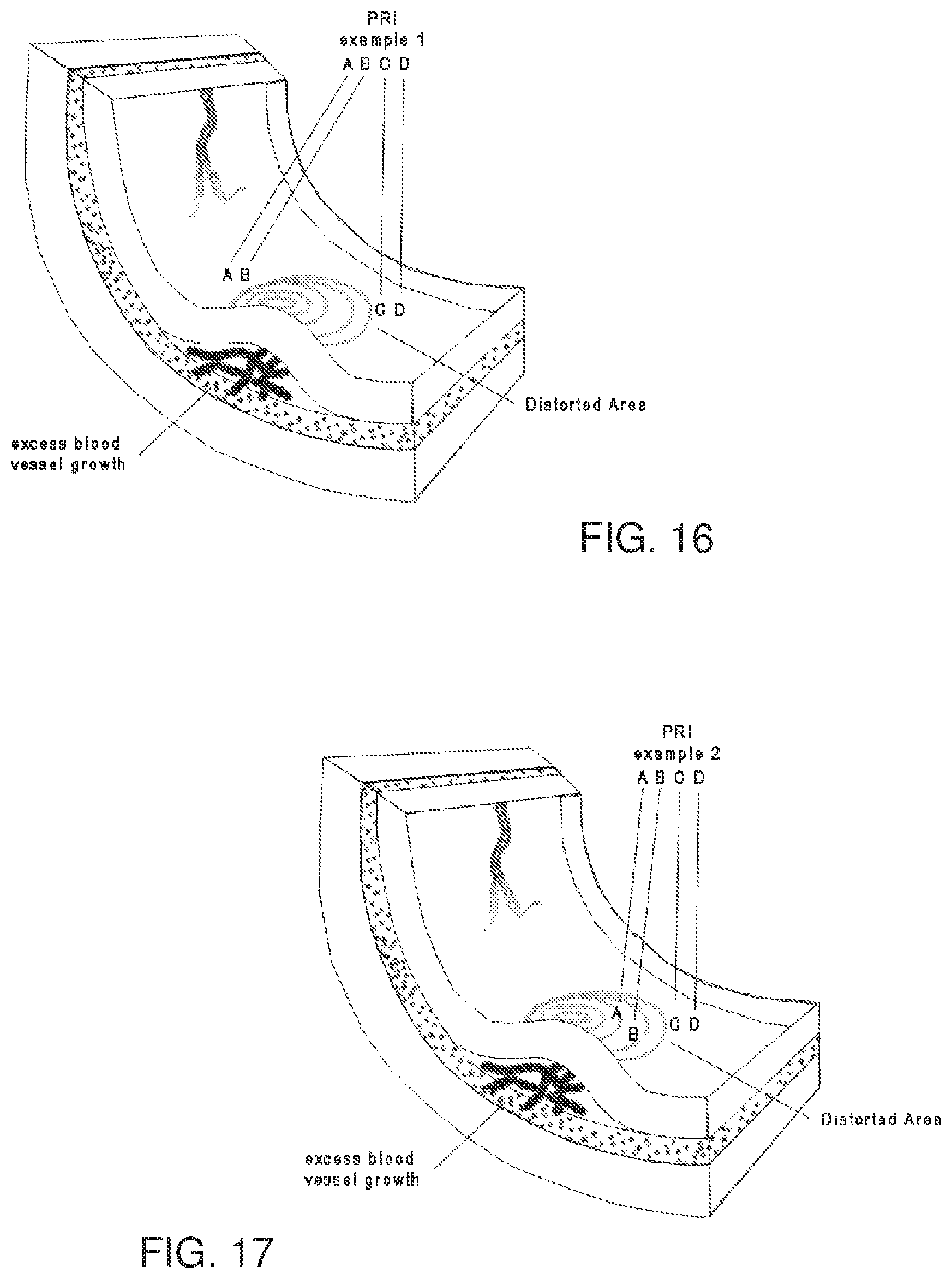 Patent US12137974 Figure 13 – System, method, and non-transitory computer-readable storage media related to correction of vision defects using a visual display