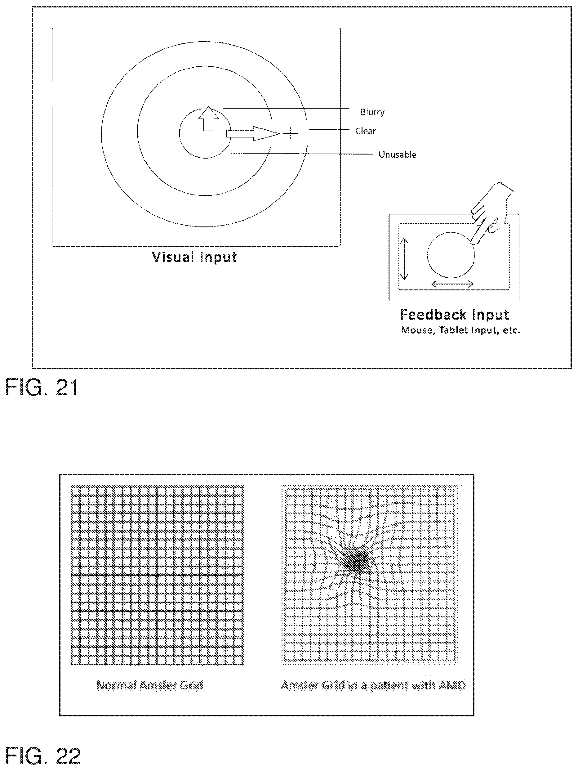 Patent US12137974 Figure 16 – System, method, and non-transitory computer-readable storage media related to correction of vision defects using a visual display