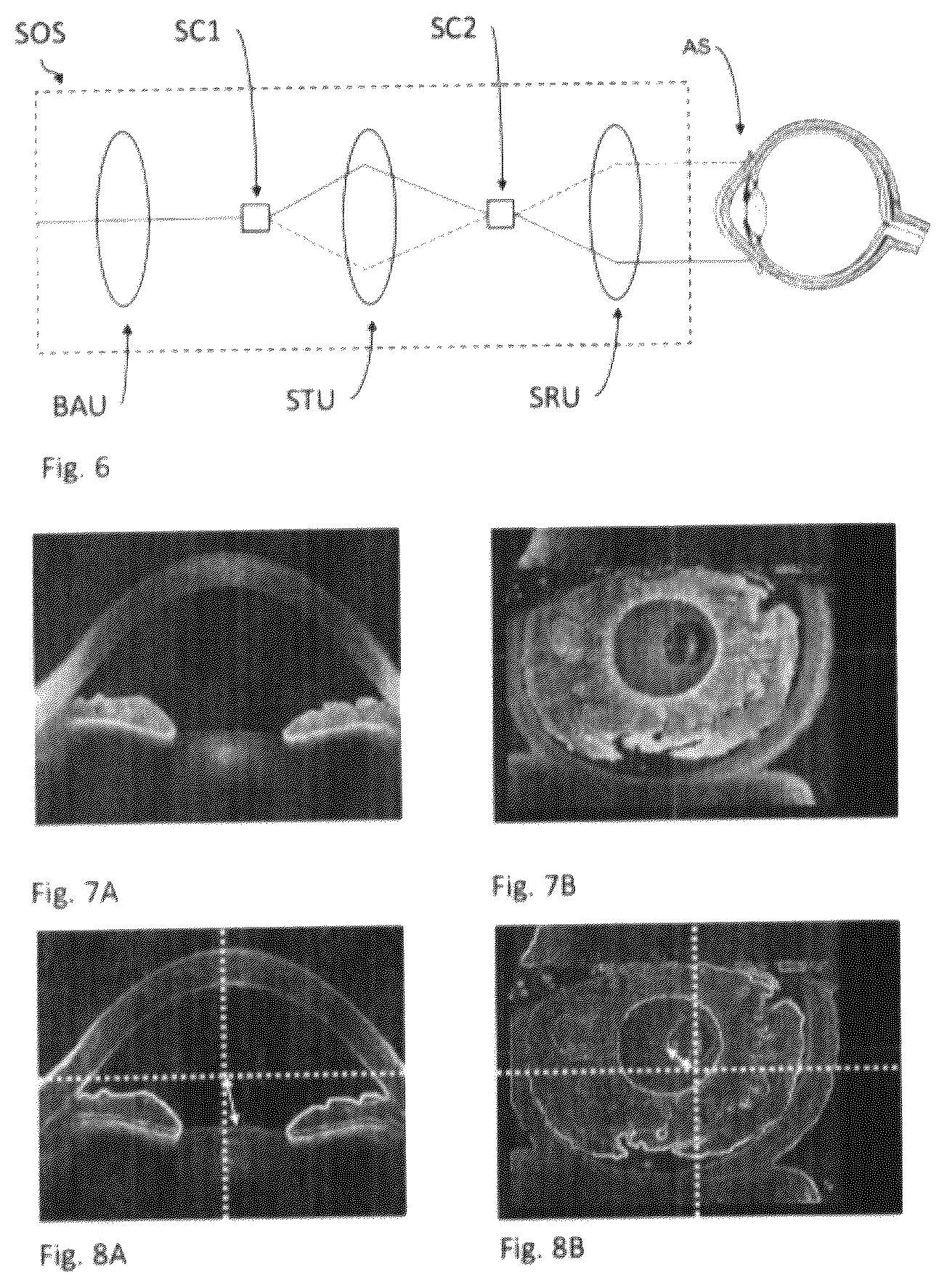 Patent US12137976 Figure 4 – Optical coherence tomography instrument and alignment method