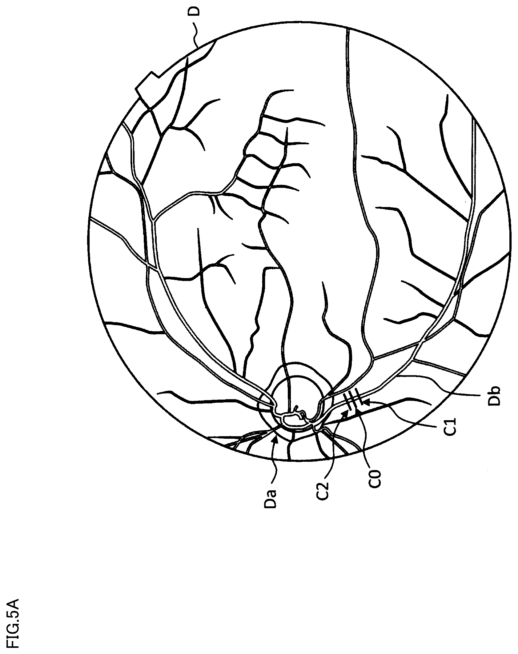 Patent US12137978 Figure 6 – Blood flow measurement apparatus, method of controlling the same, and recording medium