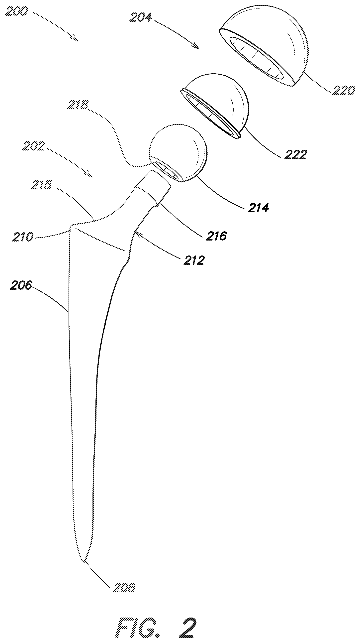 Patent US12137980 Figure 2 – Systems and methods for determining leg length change during hip surgery