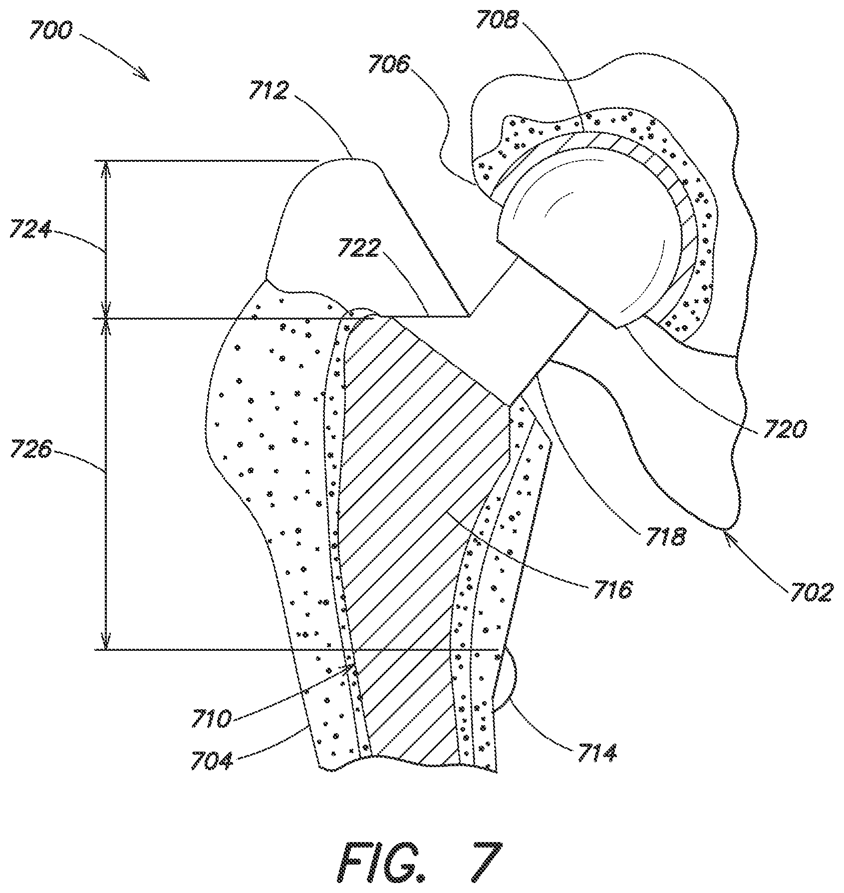 Patent US12137980 Figure 8 – Systems and methods for determining leg length change during hip surgery