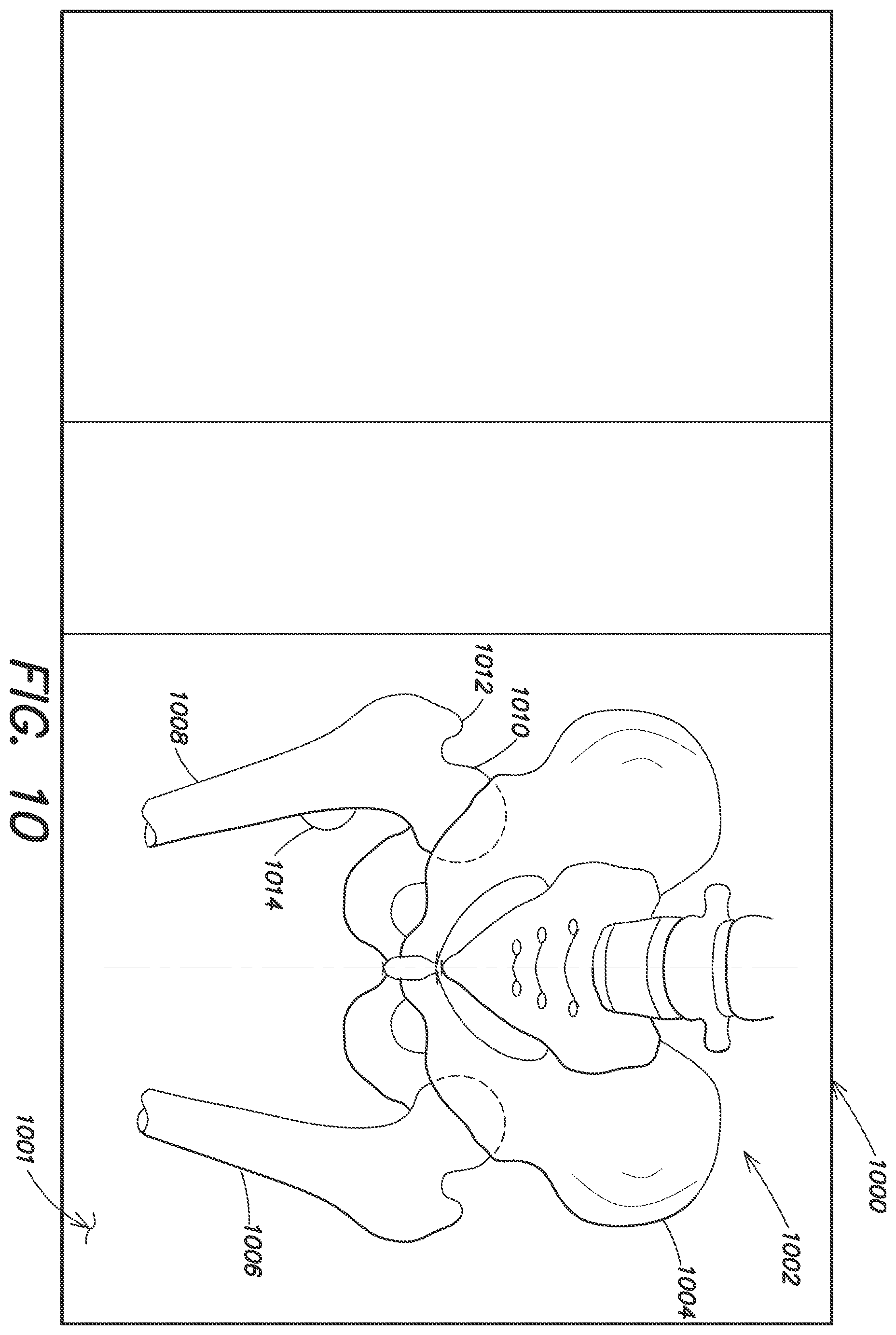 Patent US12137980 Figure 14 – Systems and methods for determining leg length change during hip surgery