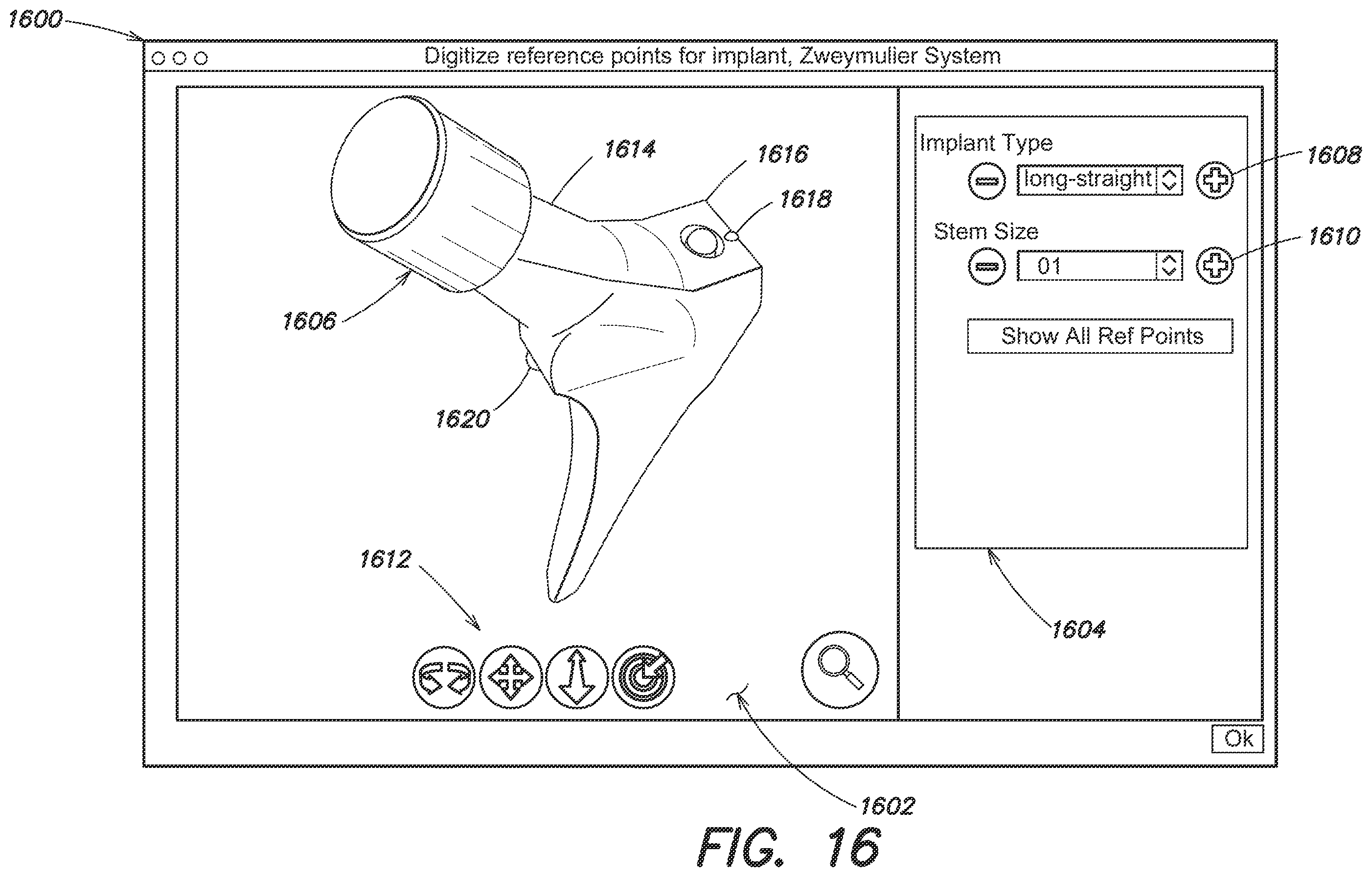 Patent US12137980 Figure 20 – Systems and methods for determining leg length change during hip surgery