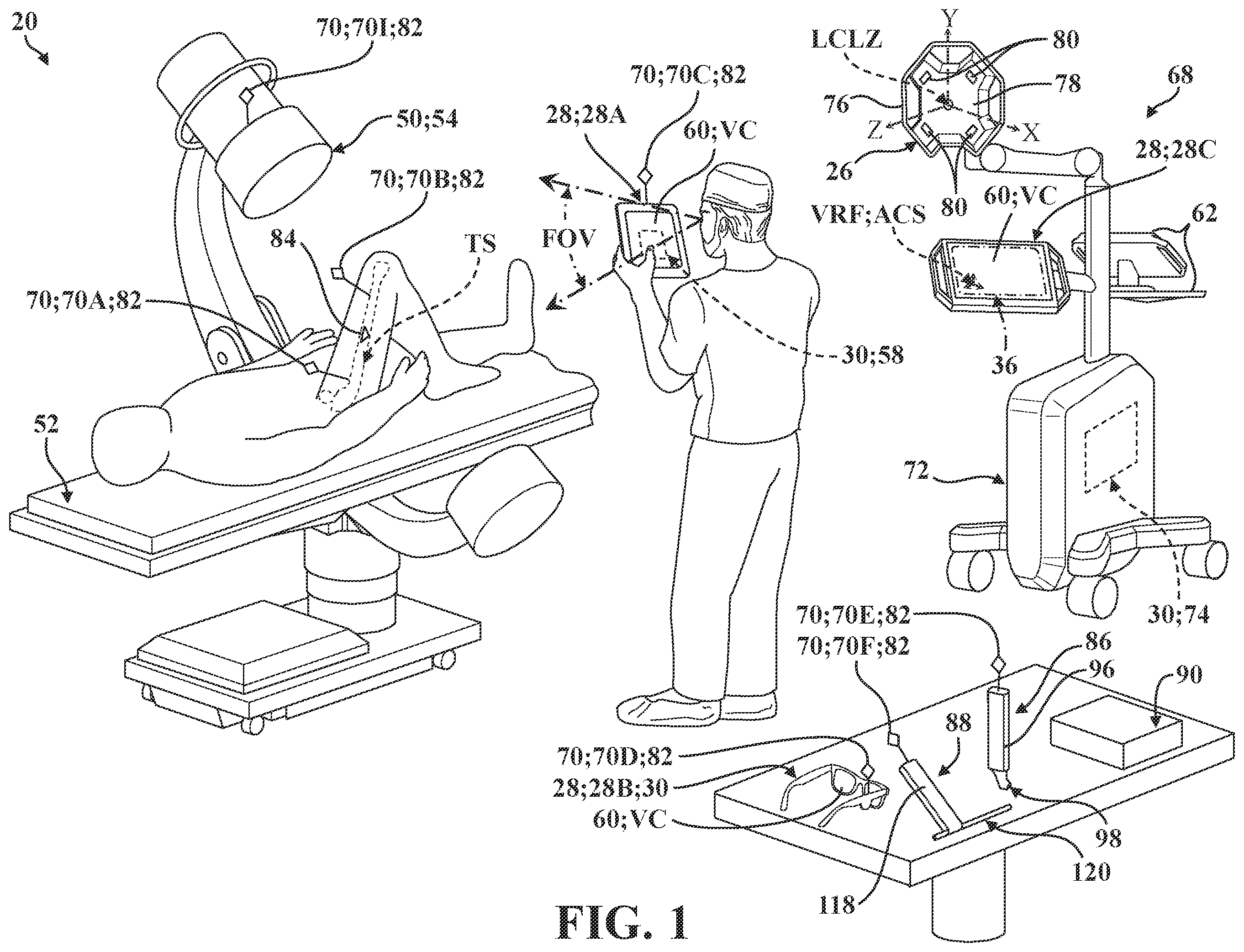 Patent US12137981 Figure 1 – Surgical systems and methods for facilitating tissue treatment
