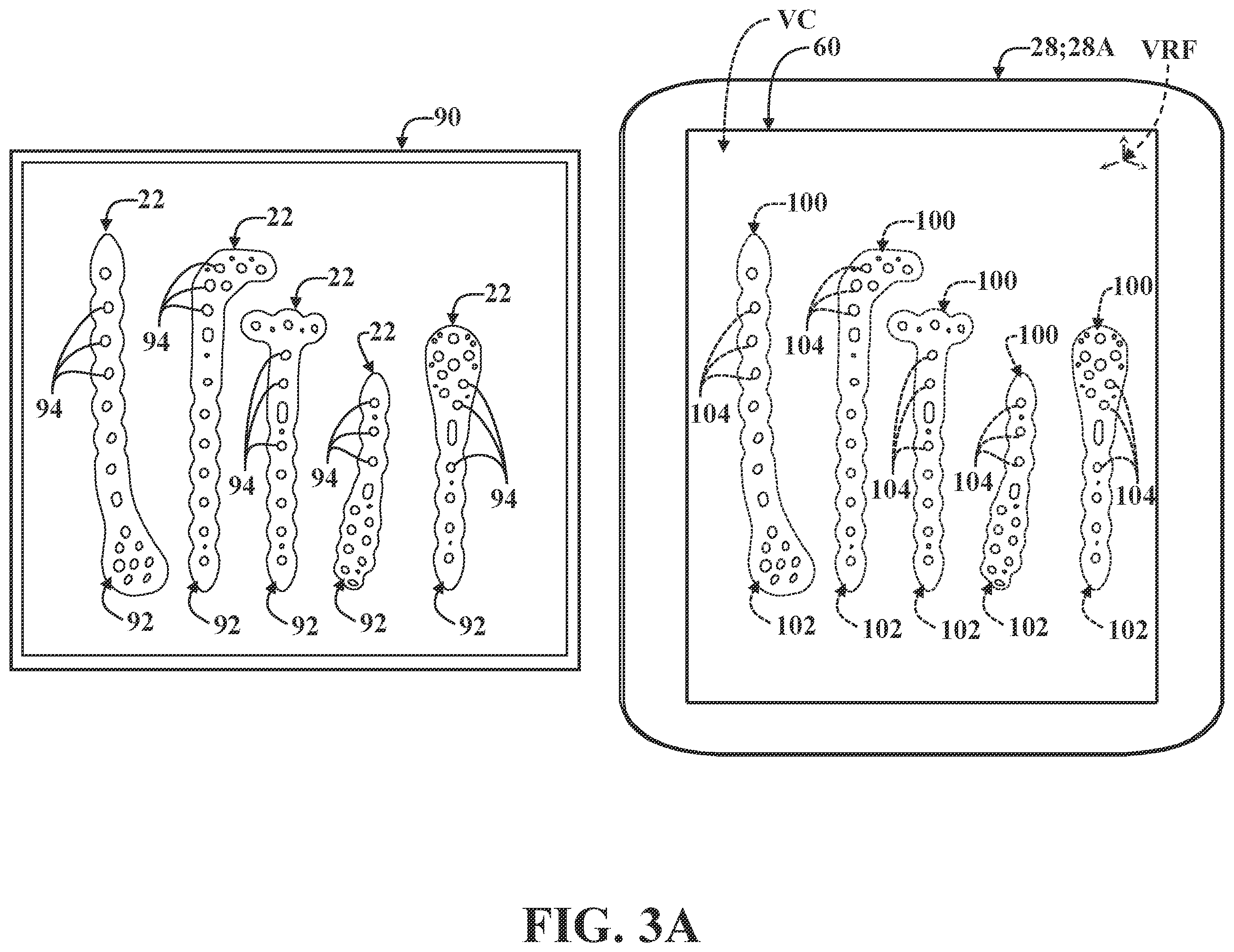 Patent US12137981 Figure 3 – Surgical systems and methods for facilitating tissue treatment