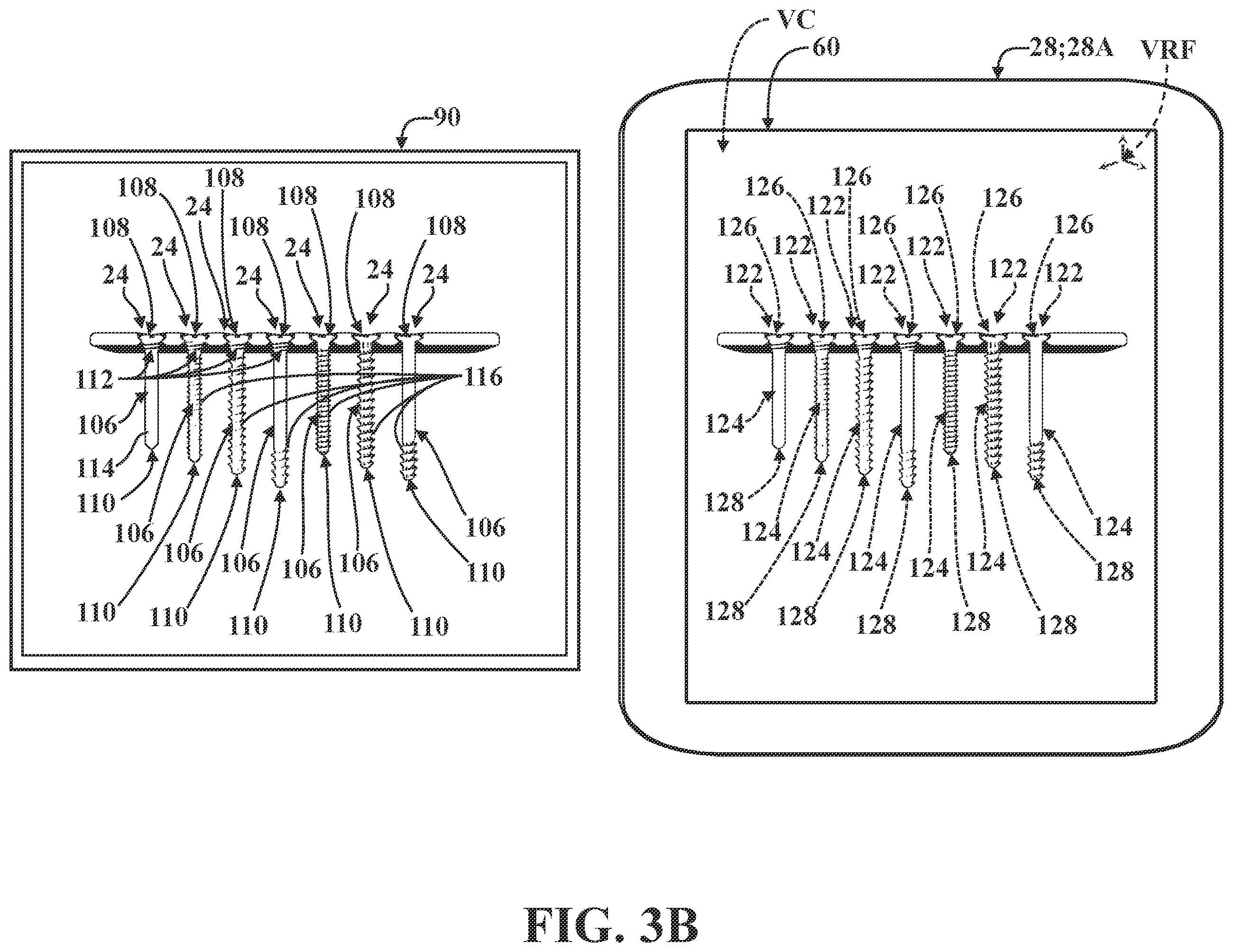 Patent US12137981 Figure 4 – Surgical systems and methods for facilitating tissue treatment