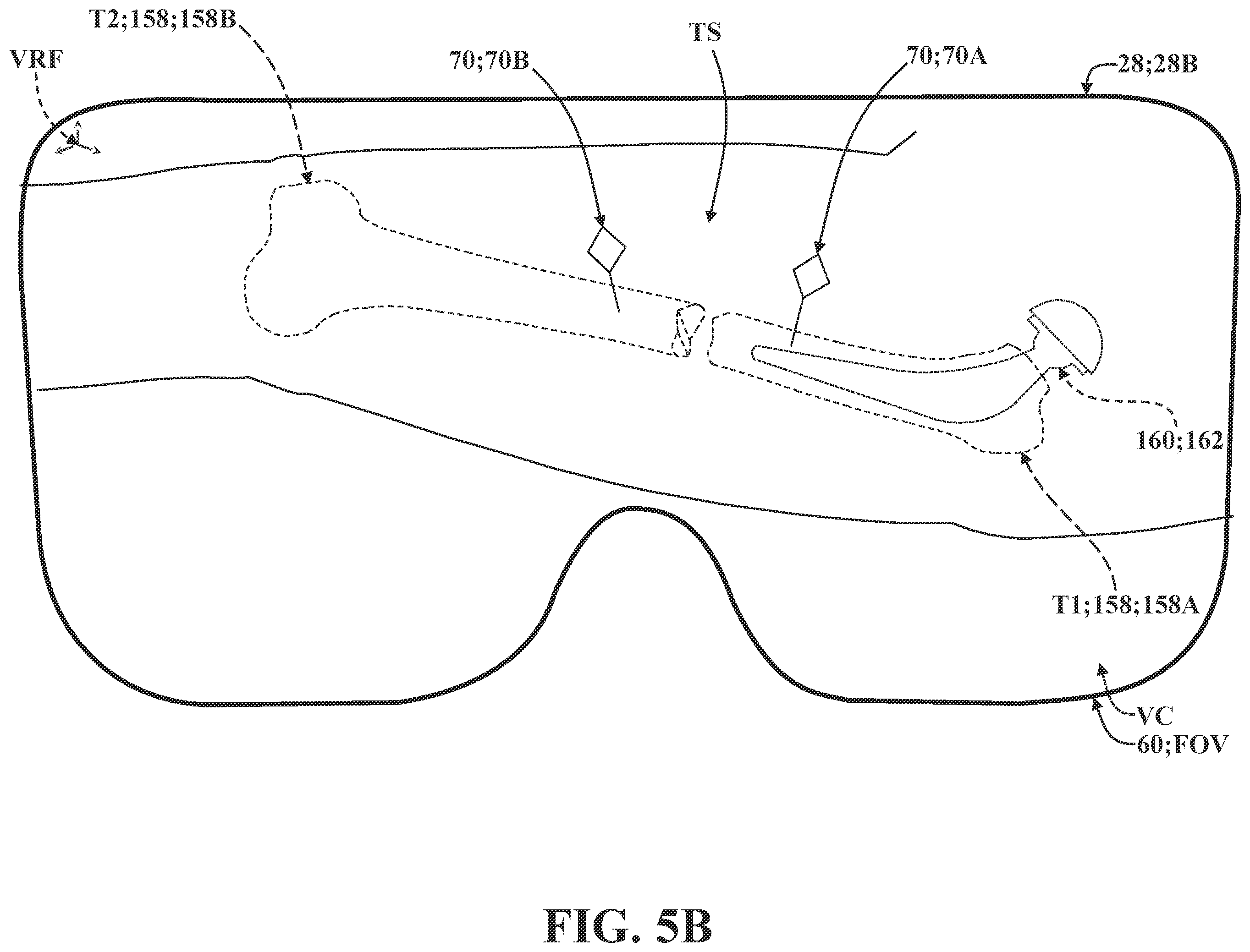 Patent US12137981 Figure 11 – Surgical systems and methods for facilitating tissue treatment