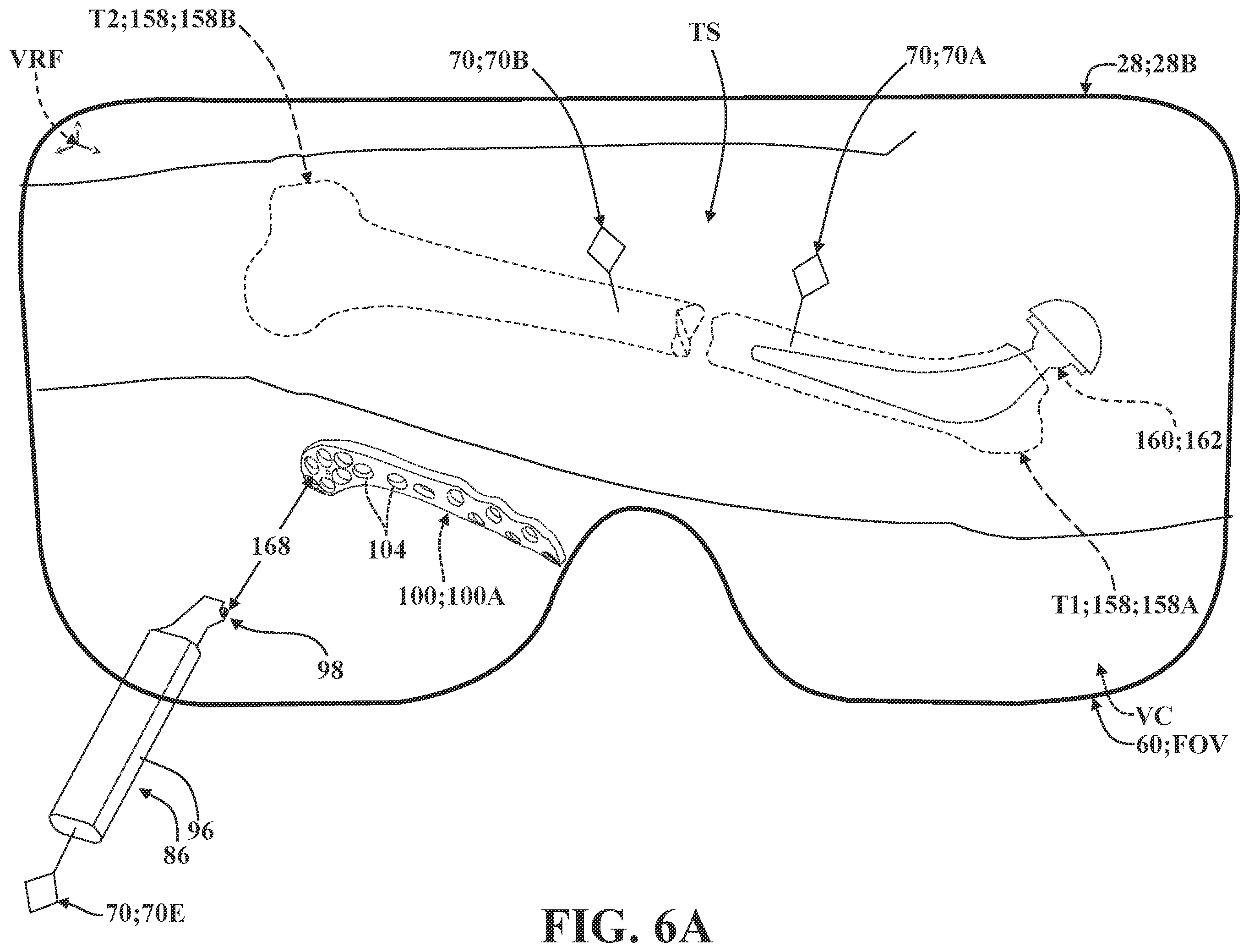 Patent US12137981 Figure 13 – Surgical systems and methods for facilitating tissue treatment