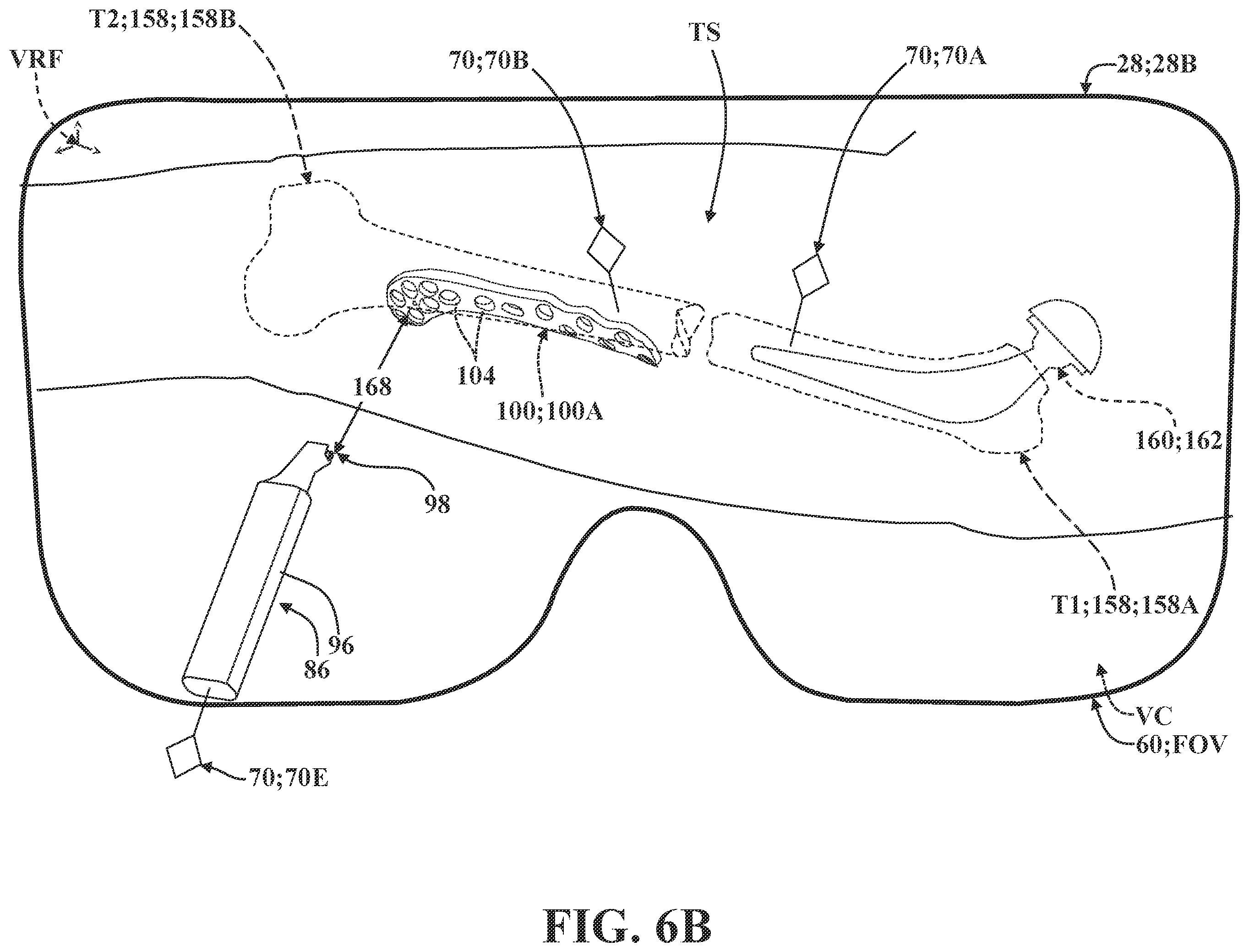 Patent US12137981 Figure 14 – Surgical systems and methods for facilitating tissue treatment