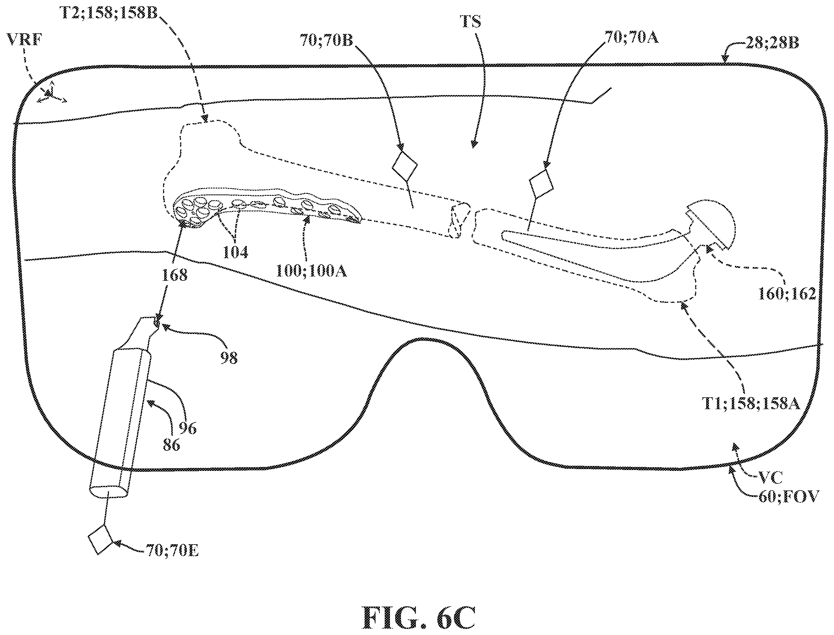 Patent US12137981 Figure 15 – Surgical systems and methods for facilitating tissue treatment