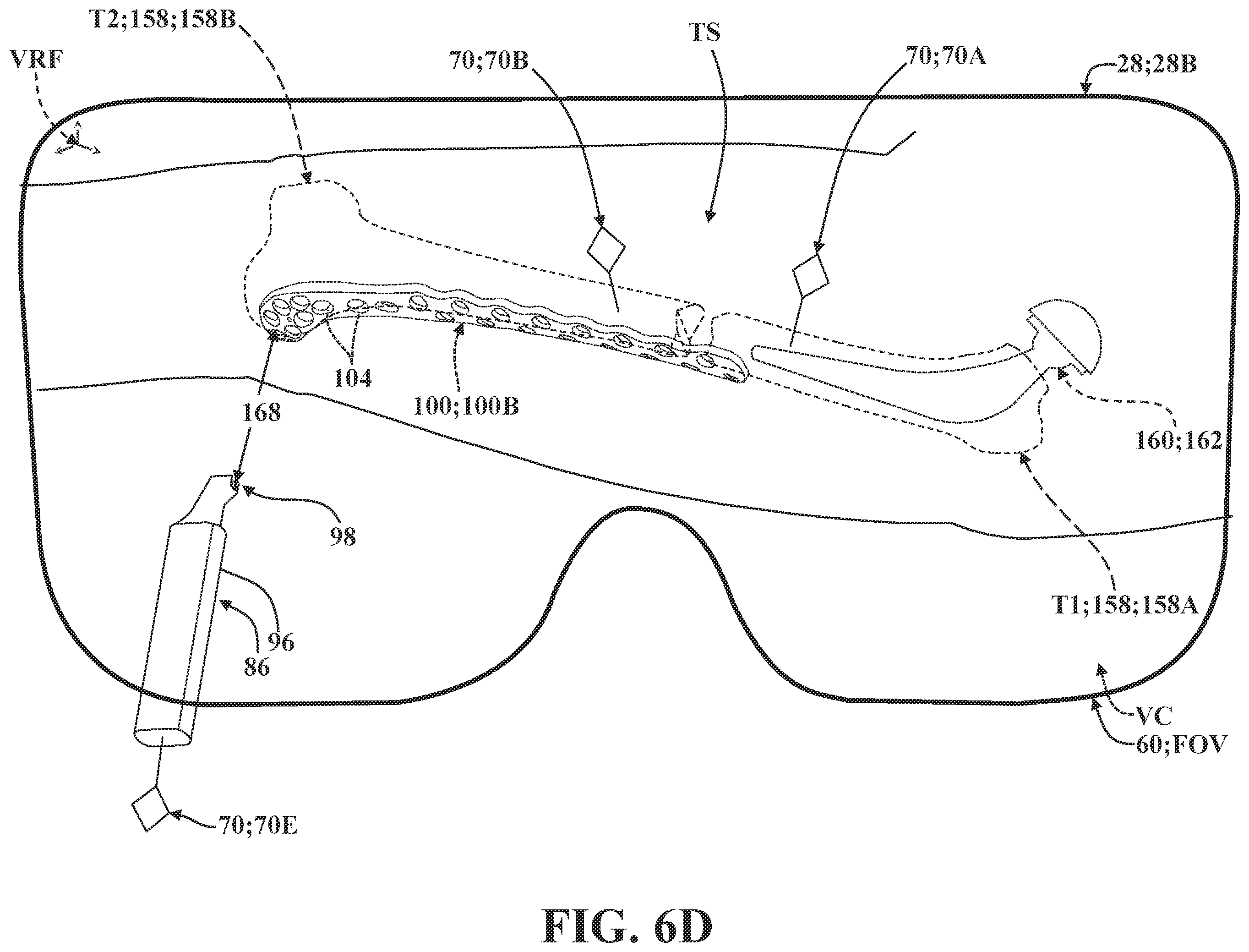 Patent US12137981 Figure 16 – Surgical systems and methods for facilitating tissue treatment
