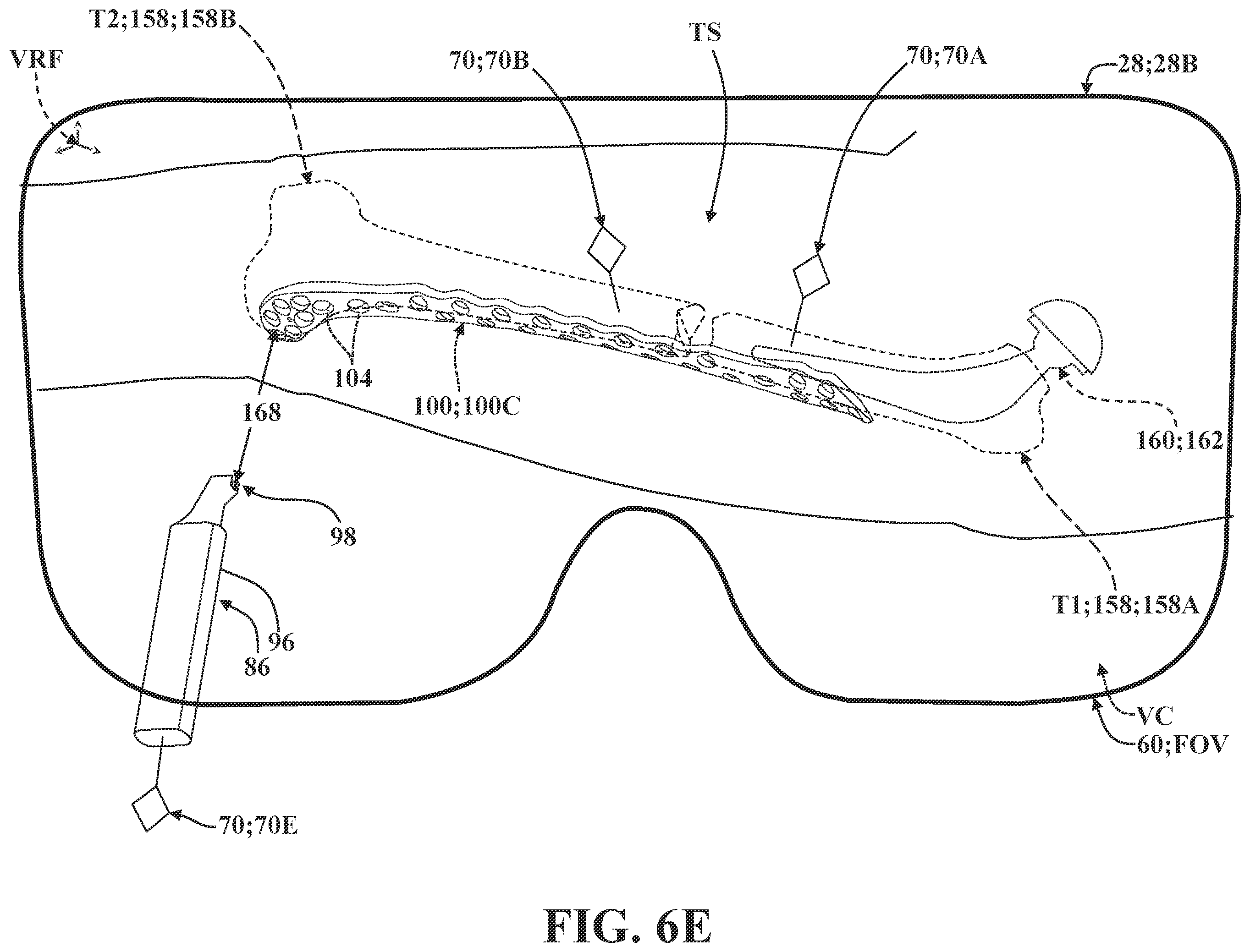 Patent US12137981 Figure 17 – Surgical systems and methods for facilitating tissue treatment