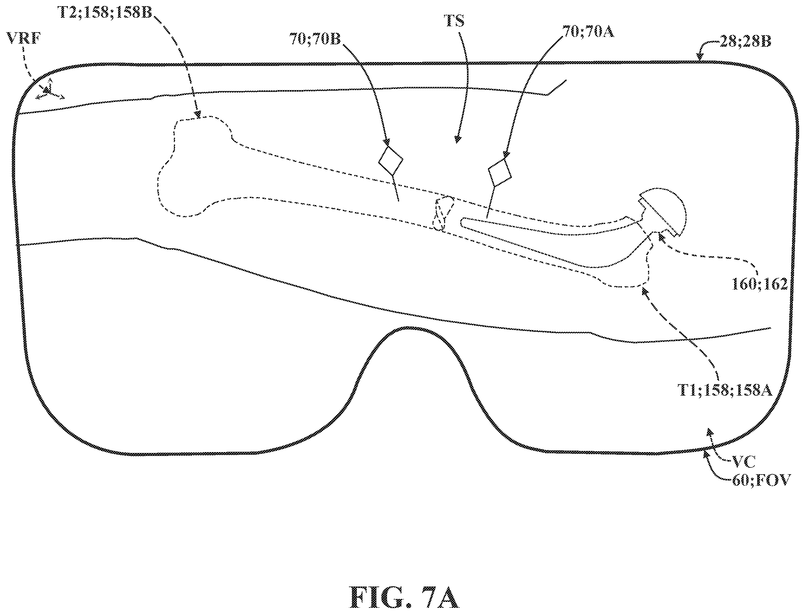 Patent US12137981 Figure 18 – Surgical systems and methods for facilitating tissue treatment
