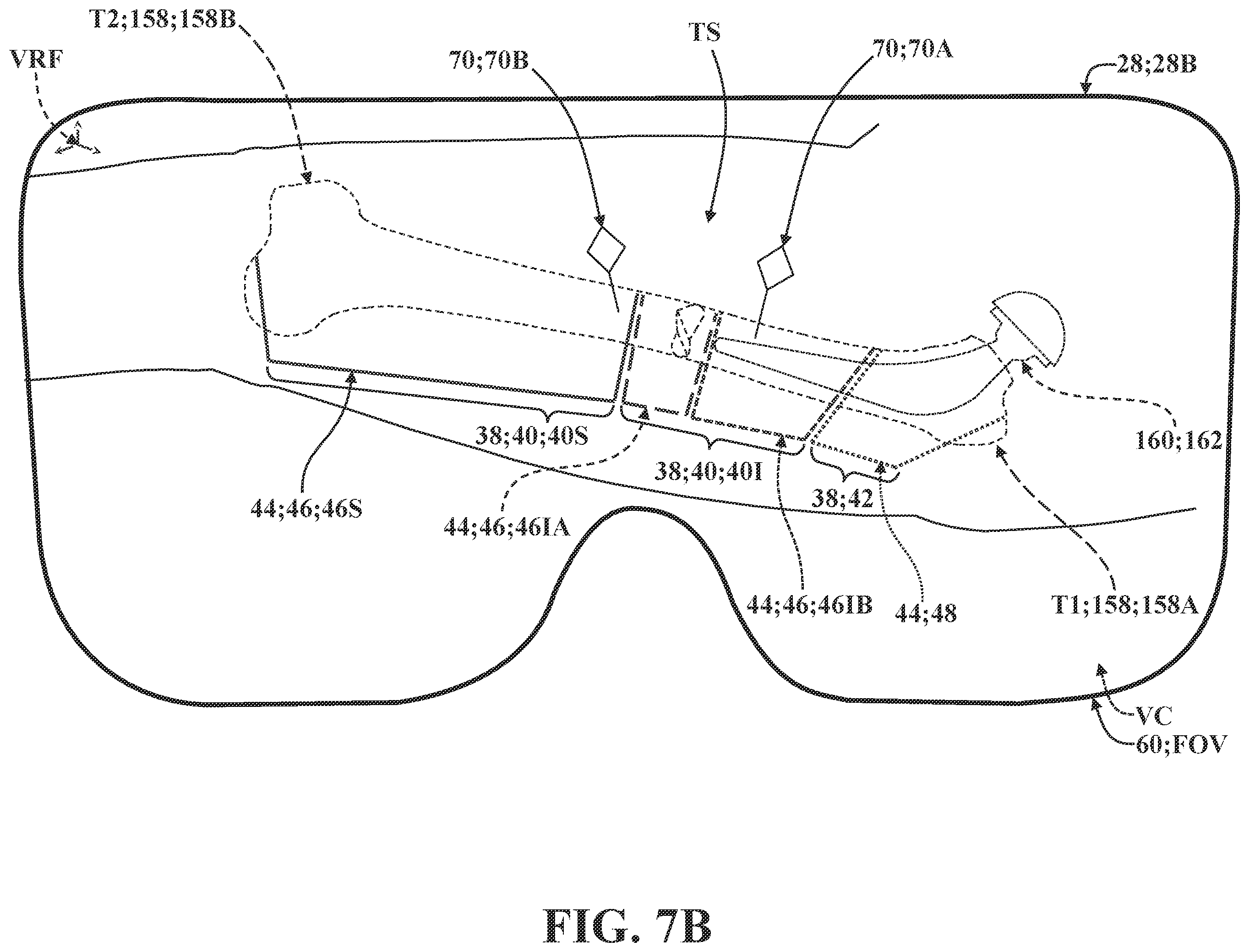 Patent US12137981 Figure 19 – Surgical systems and methods for facilitating tissue treatment