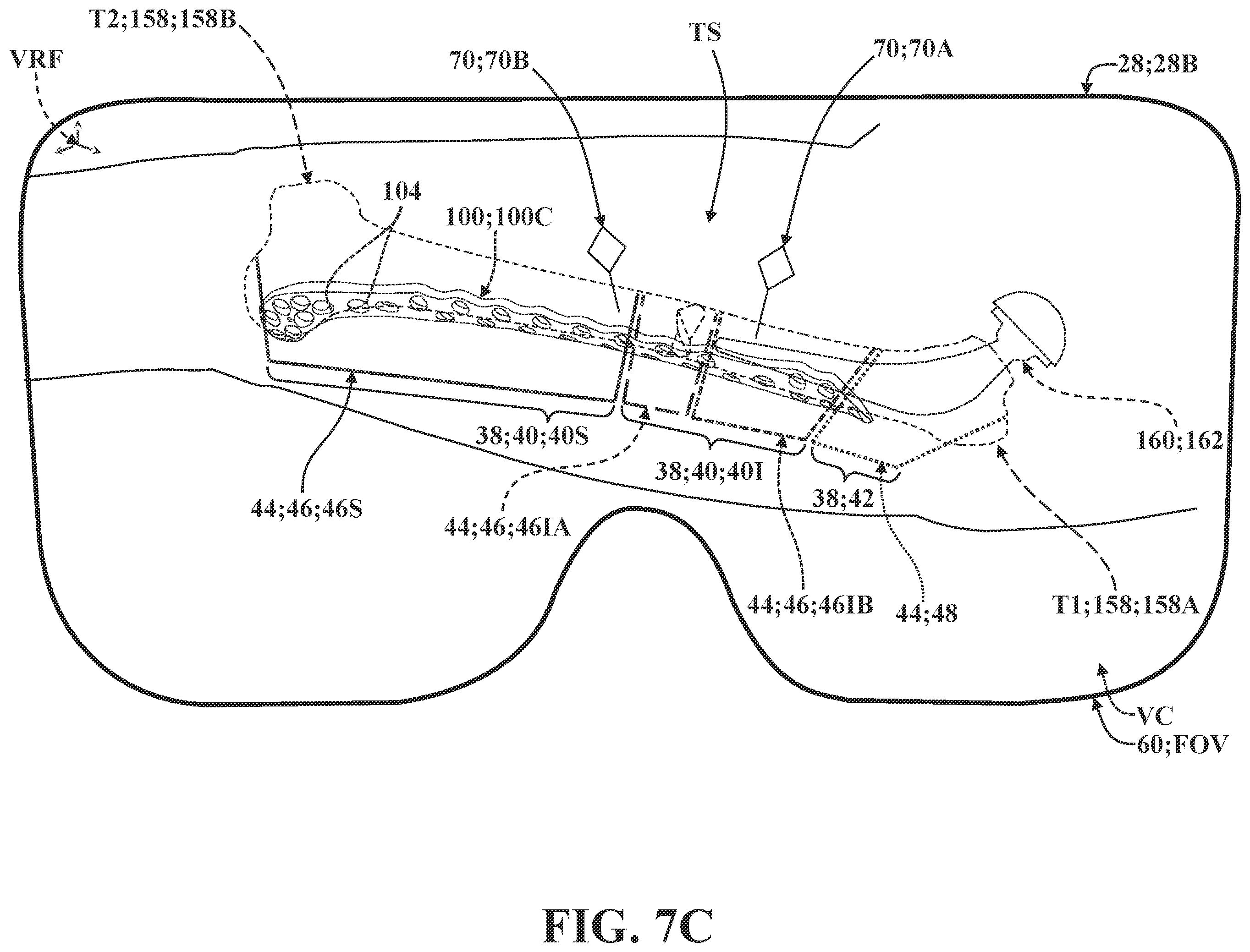 Patent US12137981 Figure 20 – Surgical systems and methods for facilitating tissue treatment