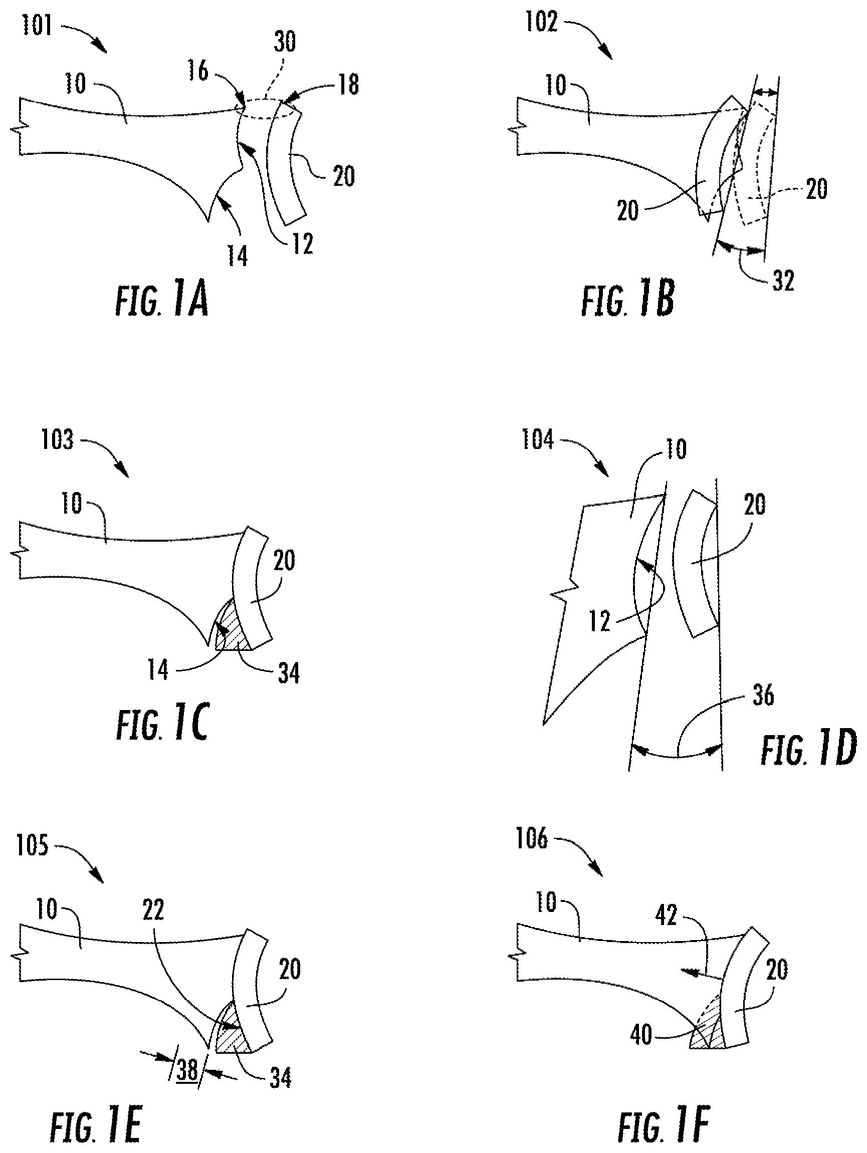 Patent US12137982 — Methods, systems and devices for pre-operatively planned shoulder surgery guides and implants — Figure 1