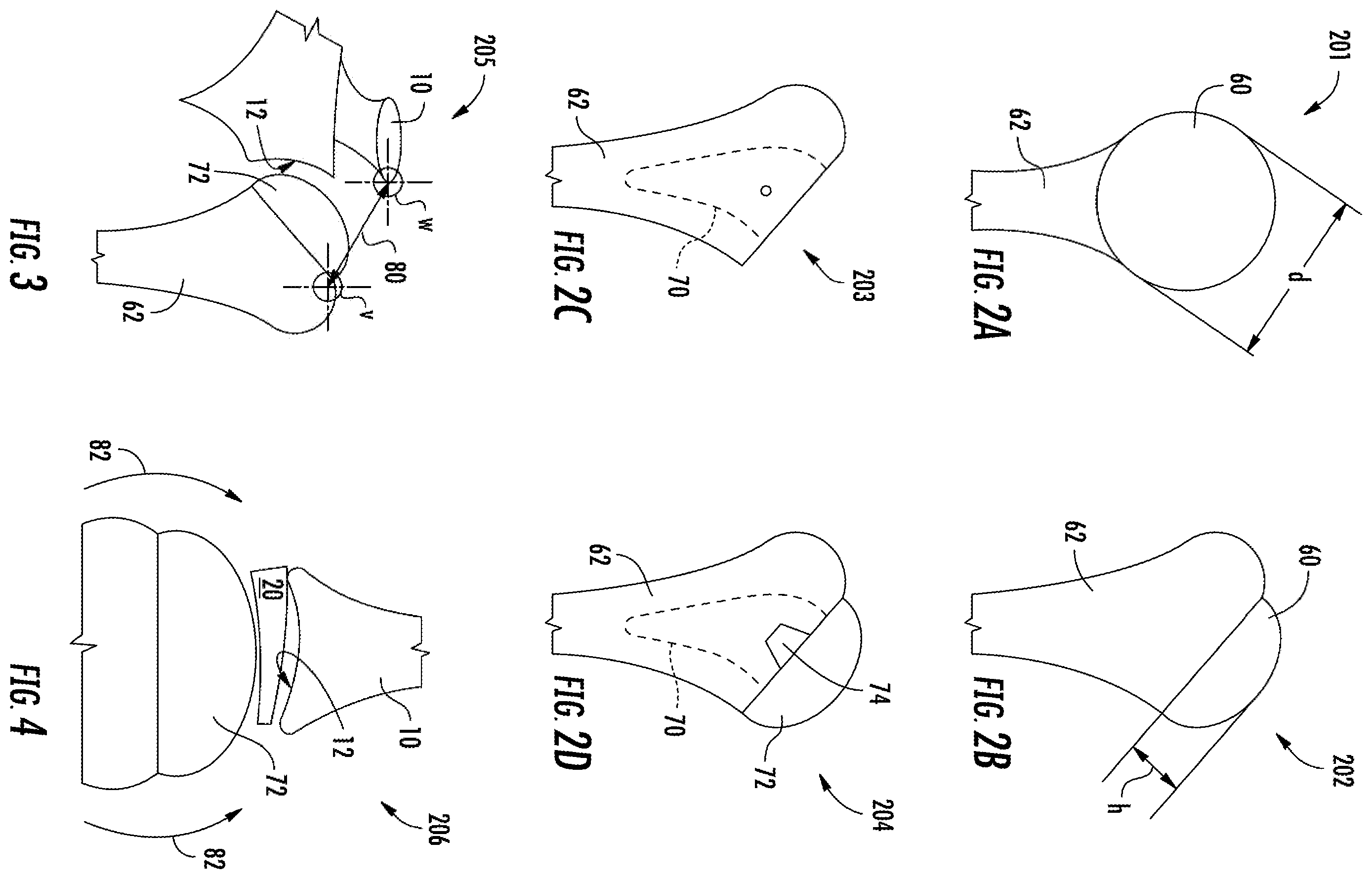 Patent US12137982 Figure 3 – Methods, systems and devices for pre-operatively planned shoulder surgery guides and implants