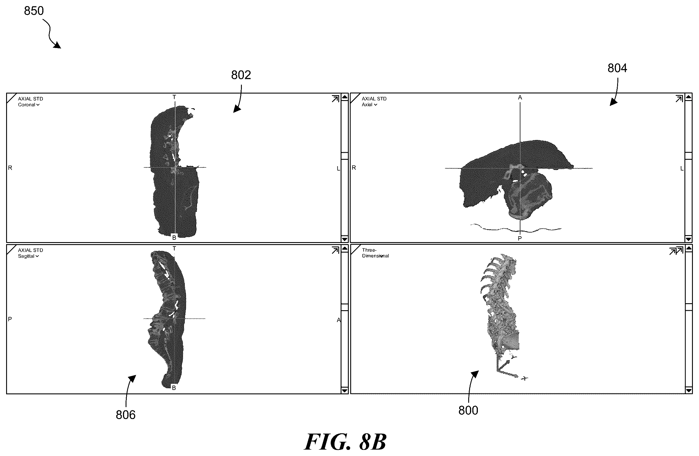 Patent US12137983 Figure 12 – Patient-specific medical systems, devices, and methods