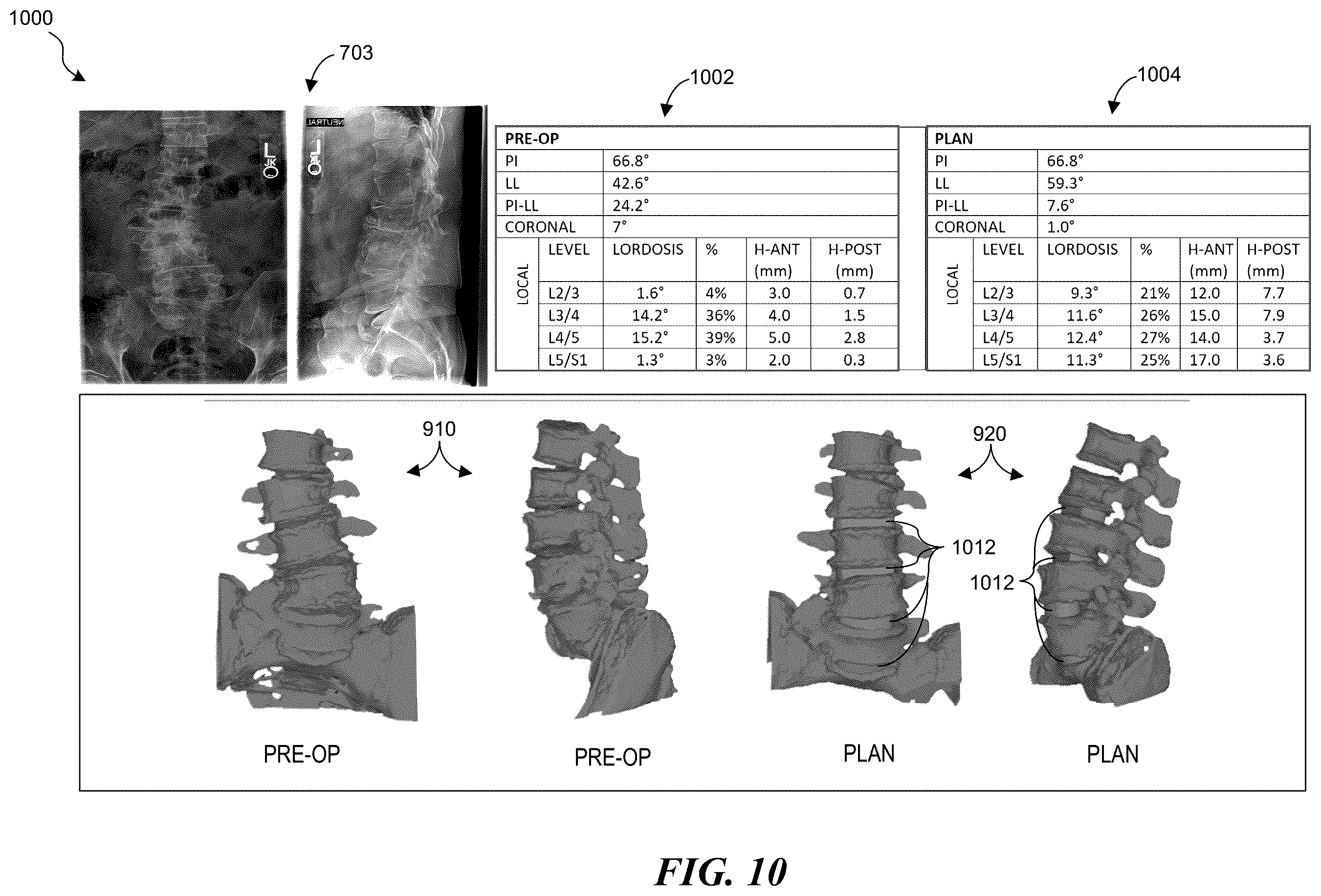 Patent US12137983 Figure 15 – Patient-specific medical systems, devices, and methods