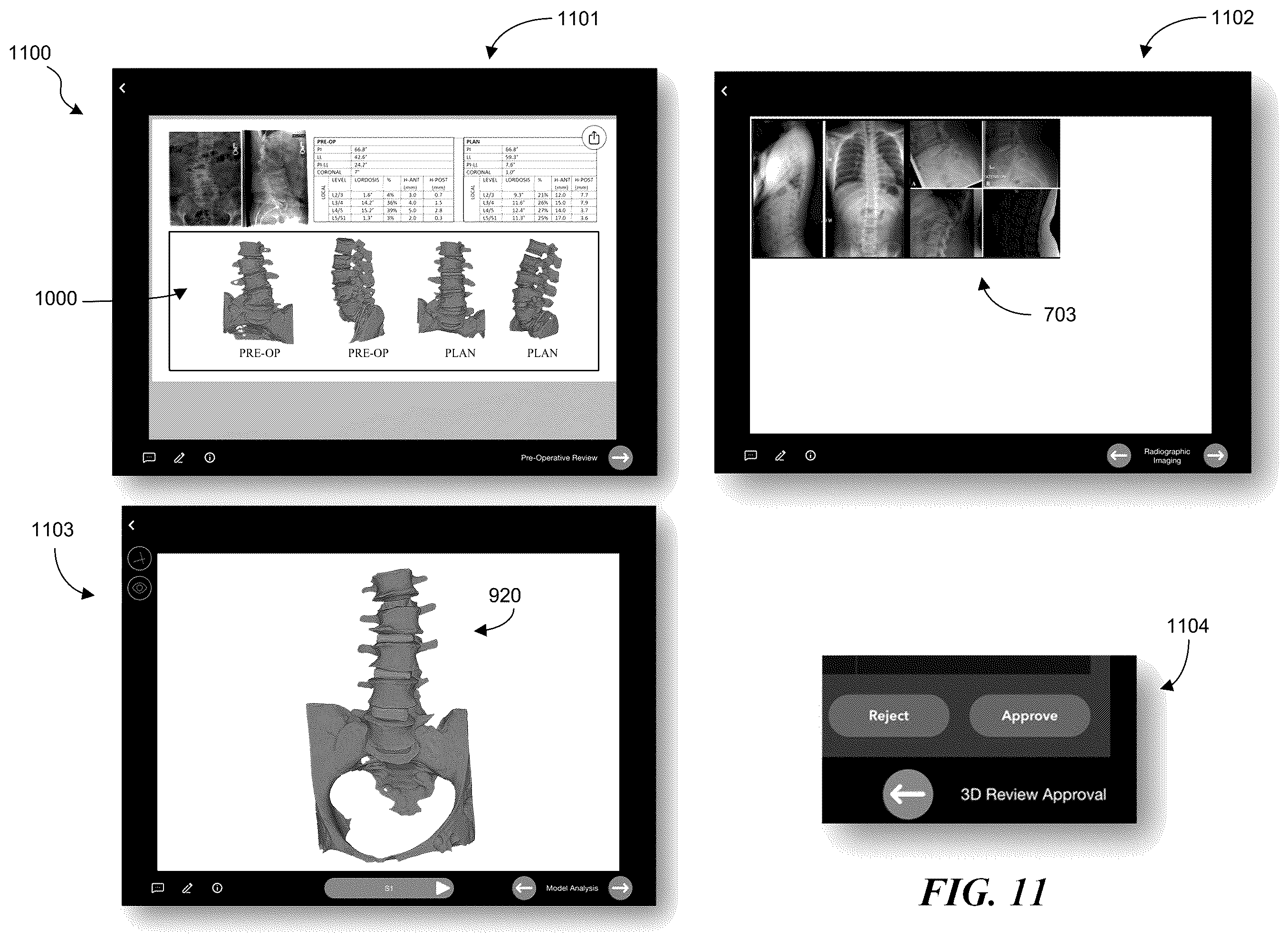 Patent US12137983 Figure 16 – Patient-specific medical systems, devices, and methods