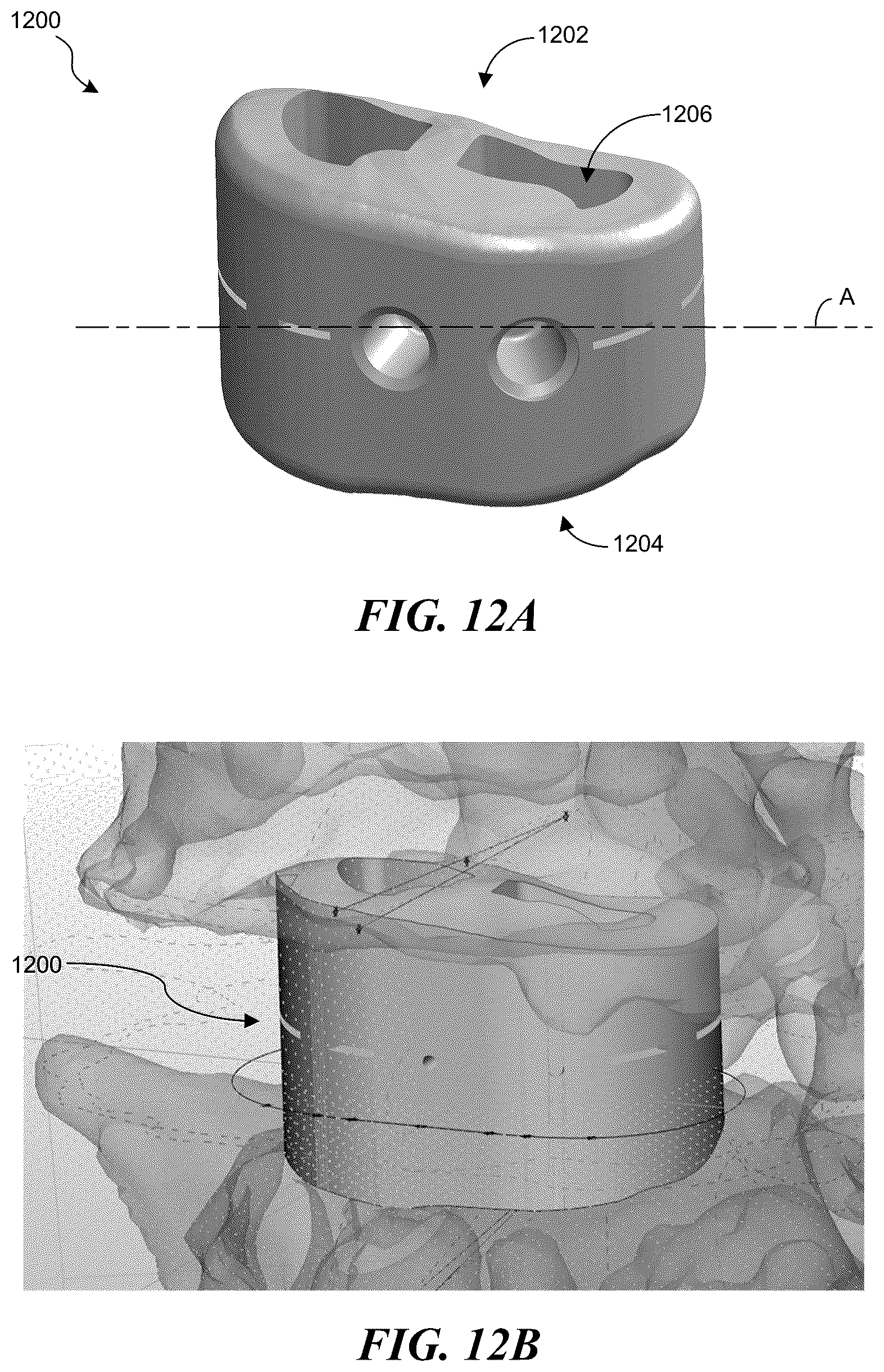 Patent US12137983 Figure 17 – Patient-specific medical systems, devices, and methods
