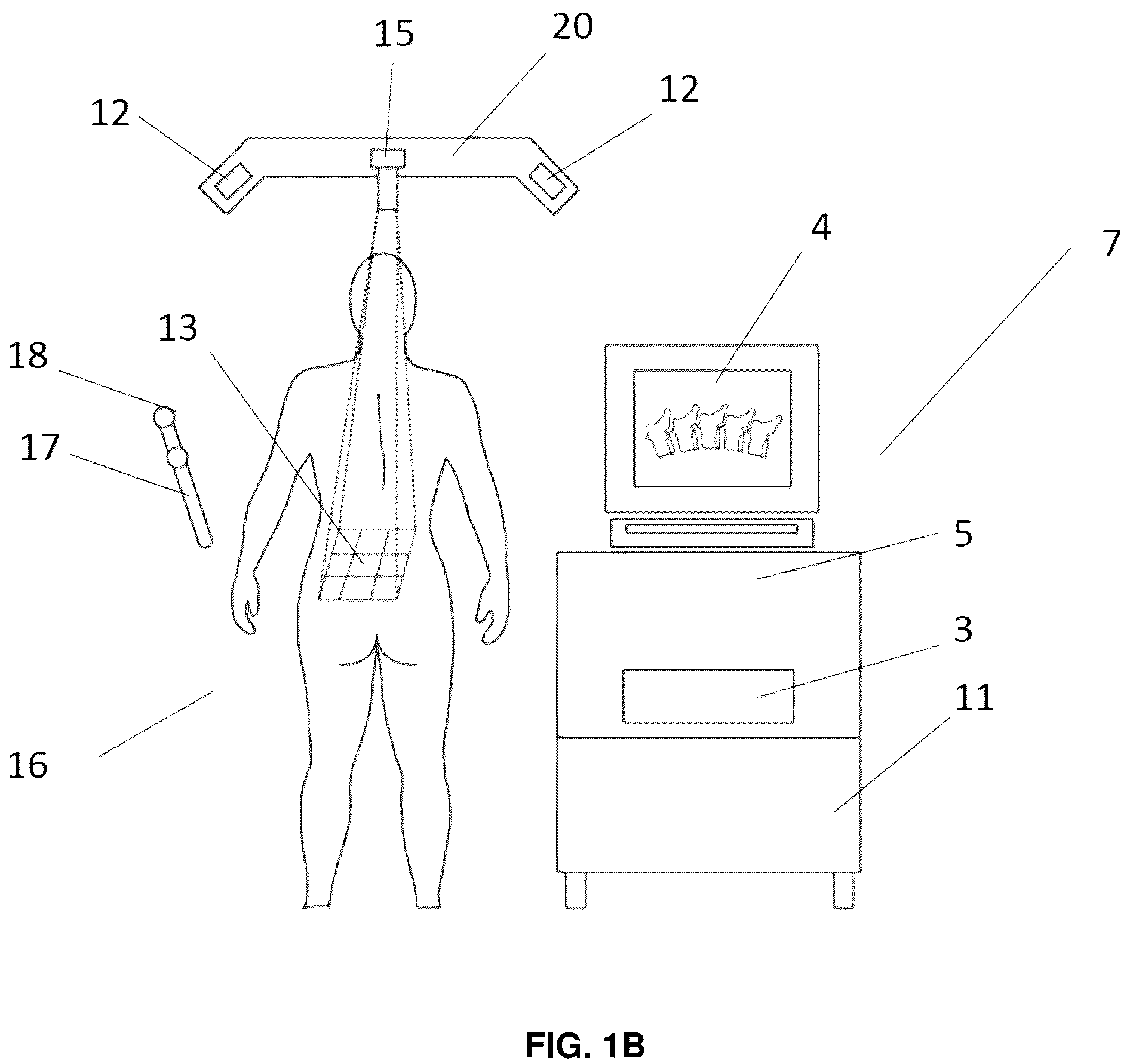 Patent US12137985 Figure 2 – System and methods for intraoperative guidance feedback