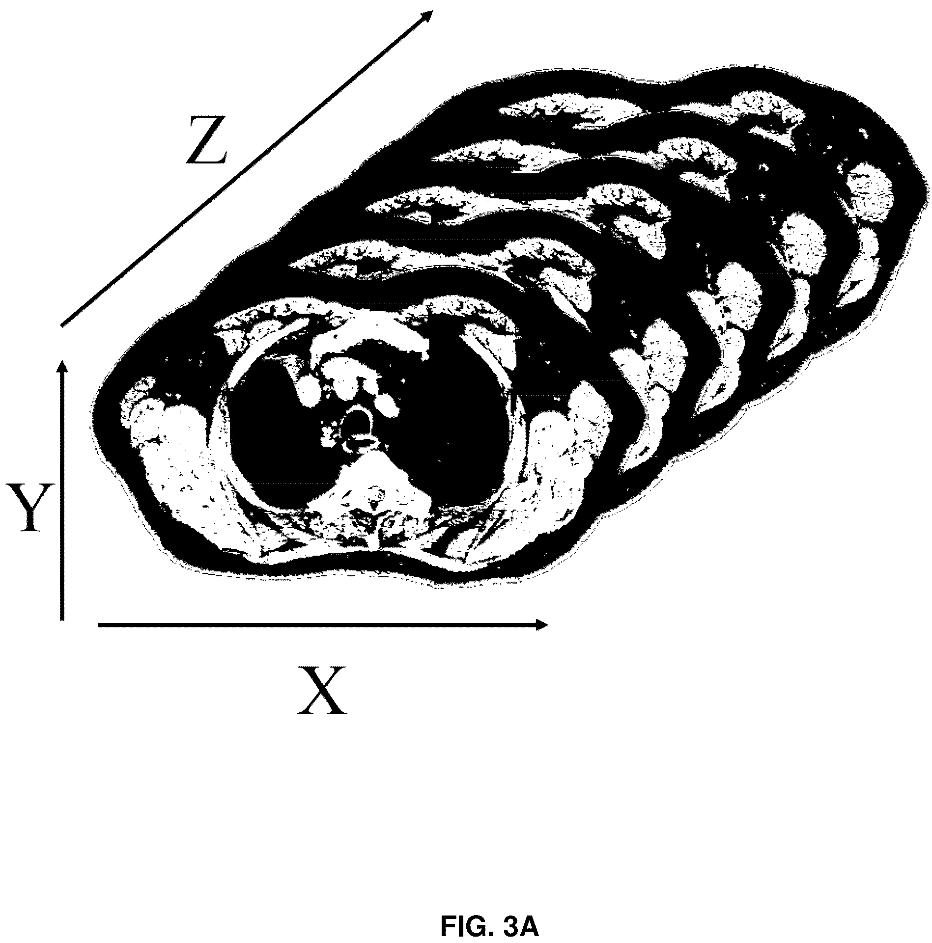 Patent US12137985 Figure 4 – System and methods for intraoperative guidance feedback