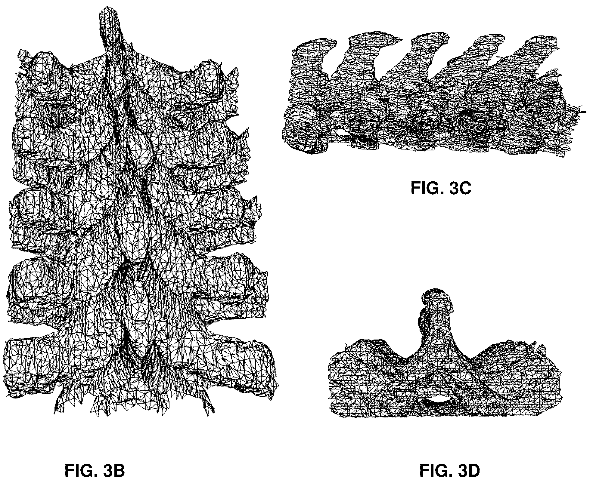 Patent US12137985 Figure 5 – System and methods for intraoperative guidance feedback