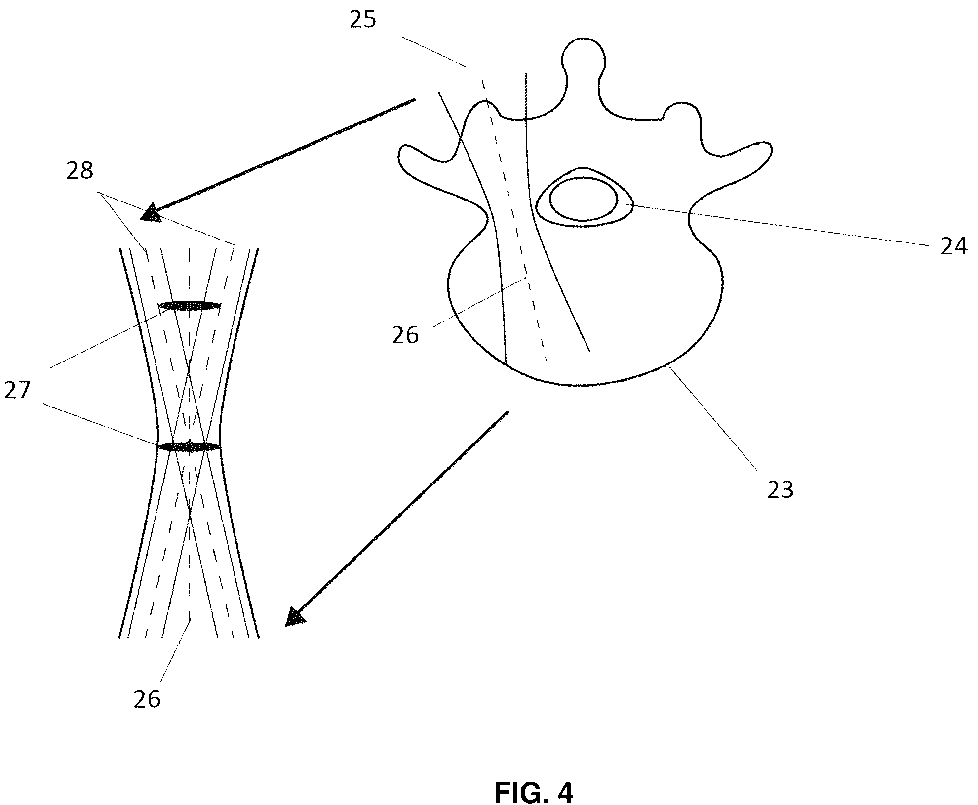 Patent US12137985 Figure 6 – System and methods for intraoperative guidance feedback