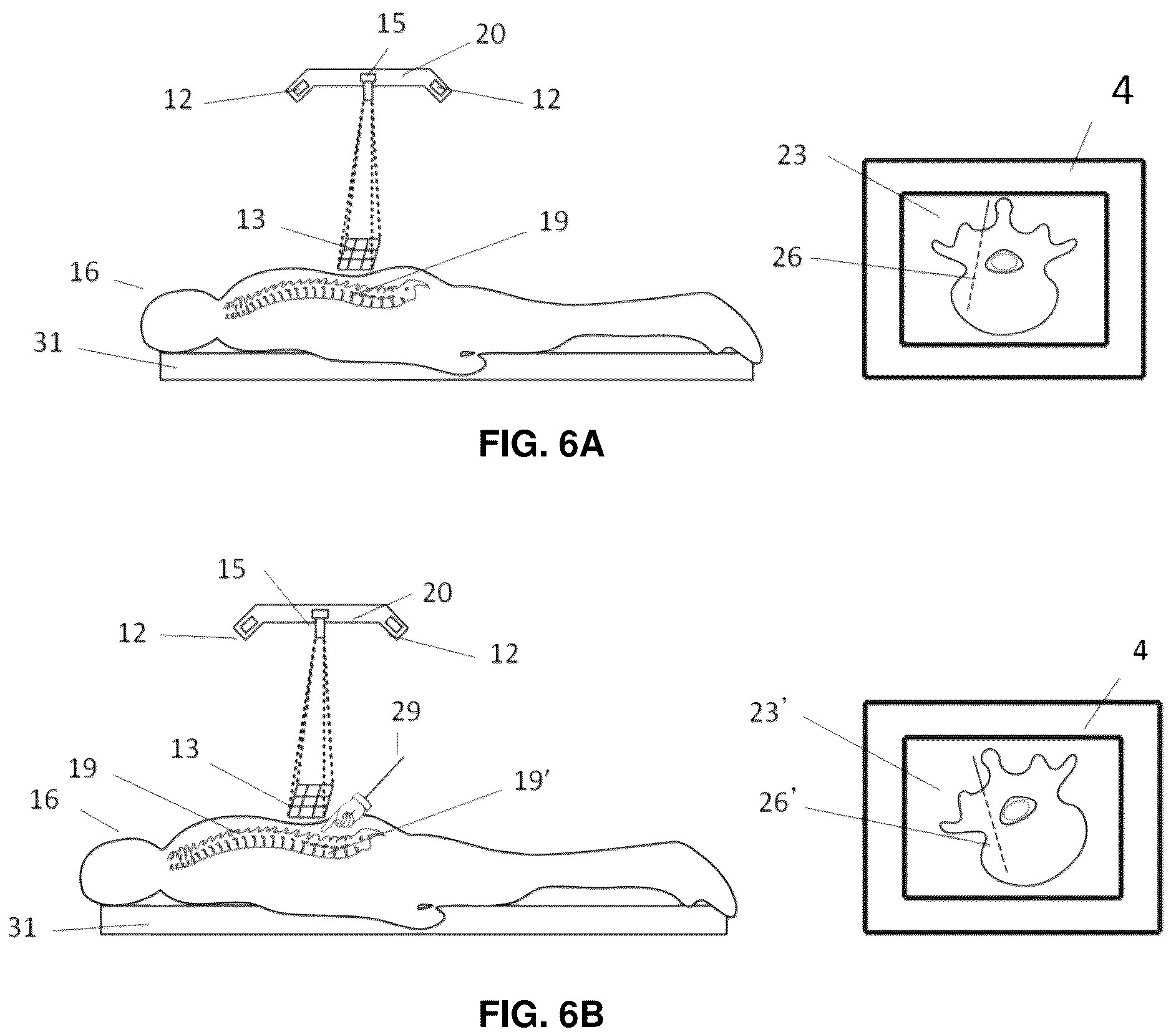 Patent US12137985 Figure 8 – System and methods for intraoperative guidance feedback