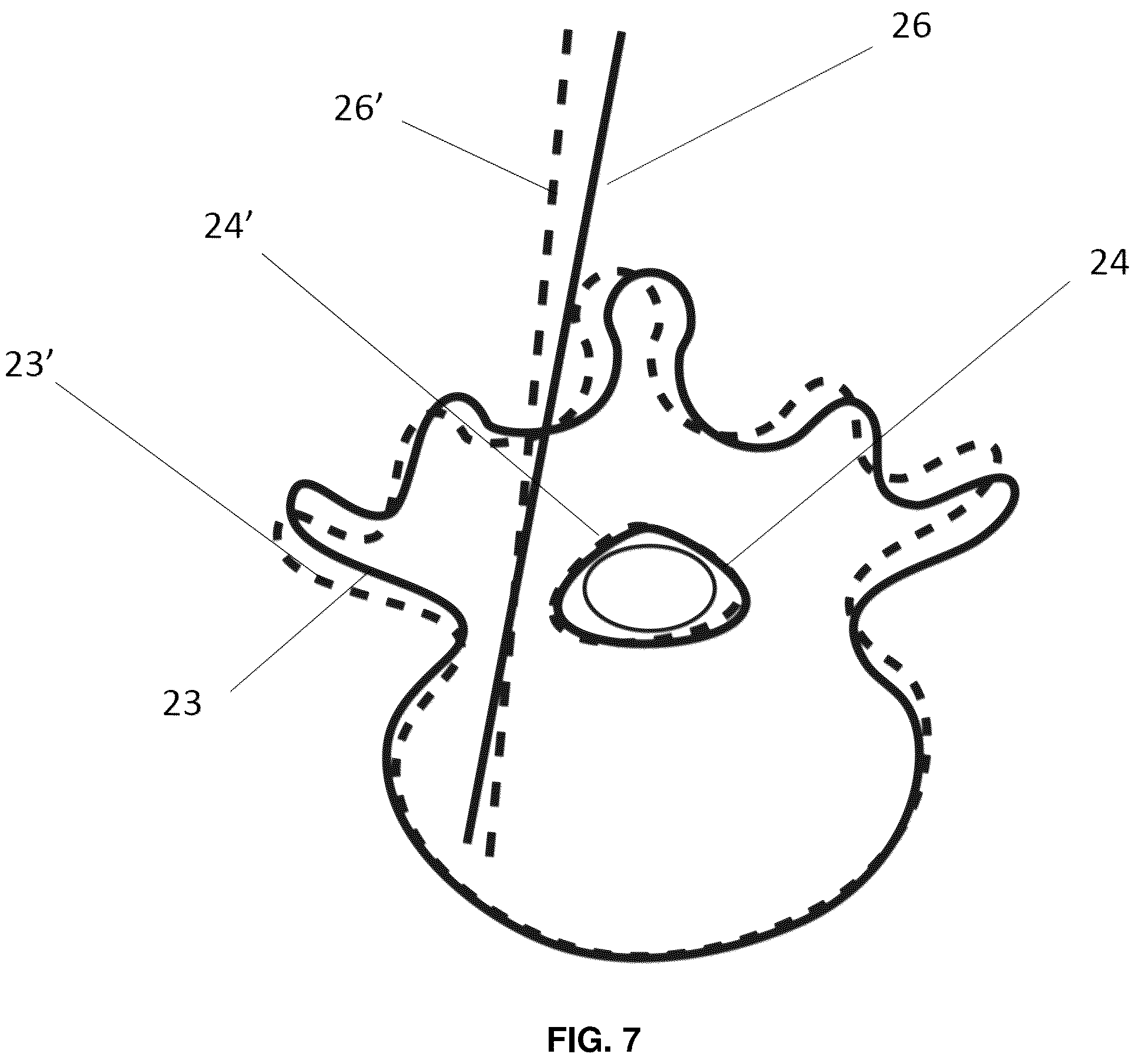 Patent US12137985 Figure 9 – System and methods for intraoperative guidance feedback