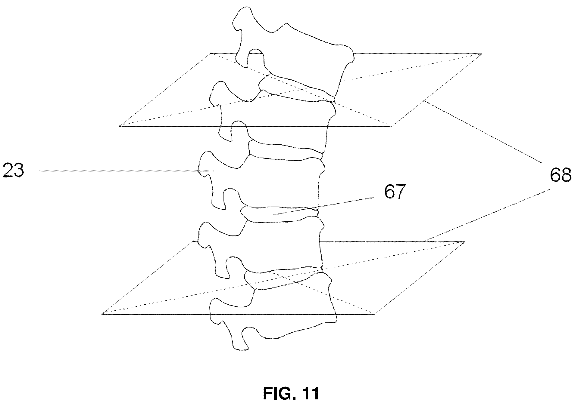 Patent US12137985 Figure 13 – System and methods for intraoperative guidance feedback