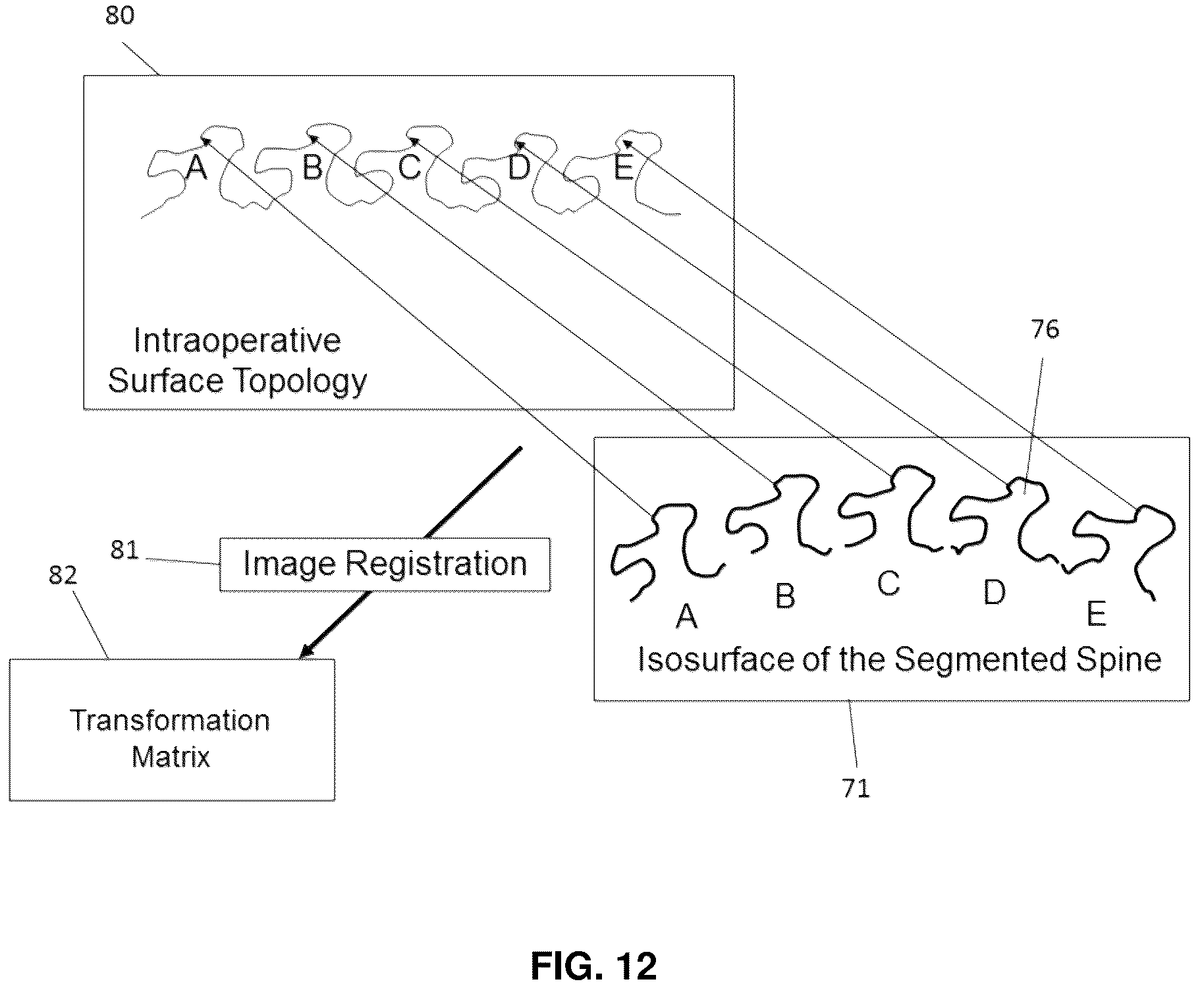 Patent US12137985 Figure 14 – System and methods for intraoperative guidance feedback