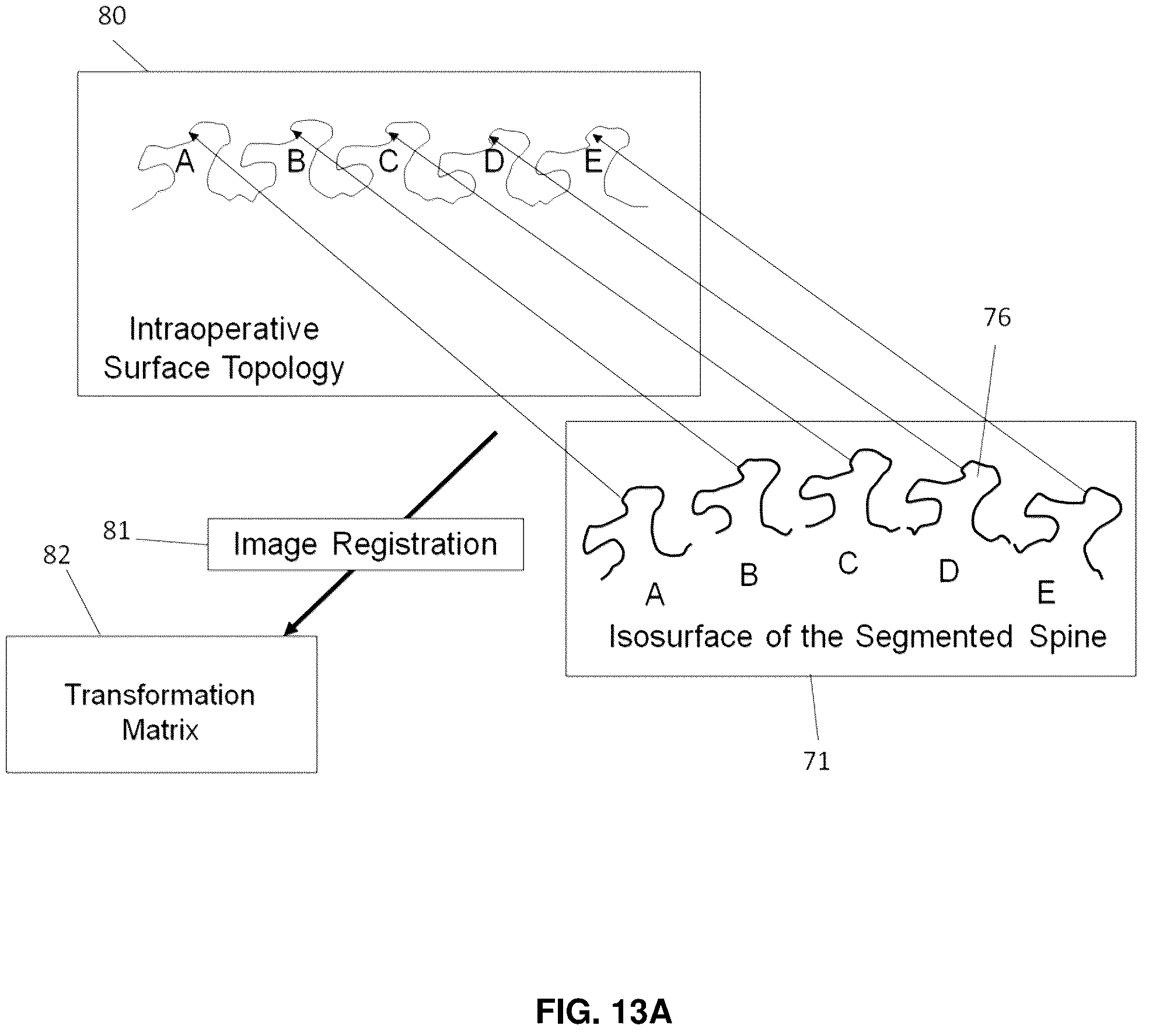 Patent US12137985 Figure 15 – System and methods for intraoperative guidance feedback