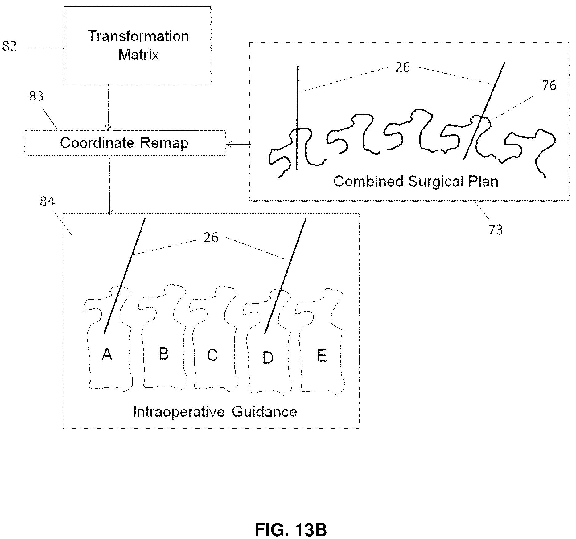Patent US12137985 Figure 16 – System and methods for intraoperative guidance feedback