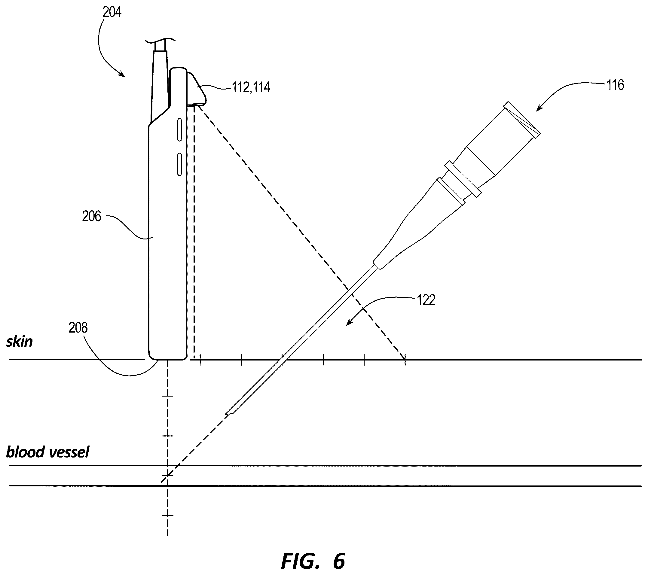 Patent US12137987 Figure 5 – Ultrasound systems and methods for sustained spatial attention
