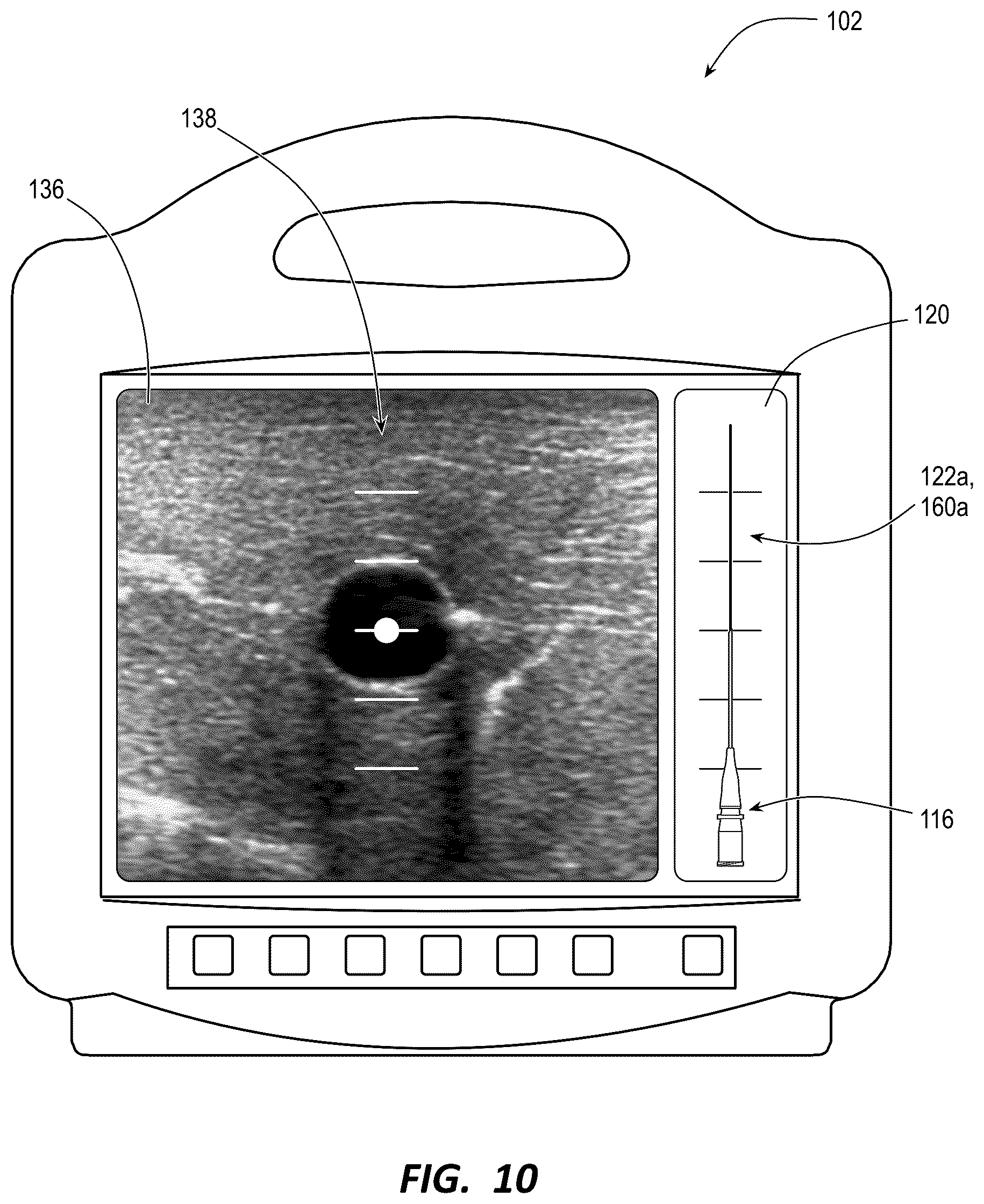 Patent US12137987 Figure 8 – Ultrasound systems and methods for sustained spatial attention