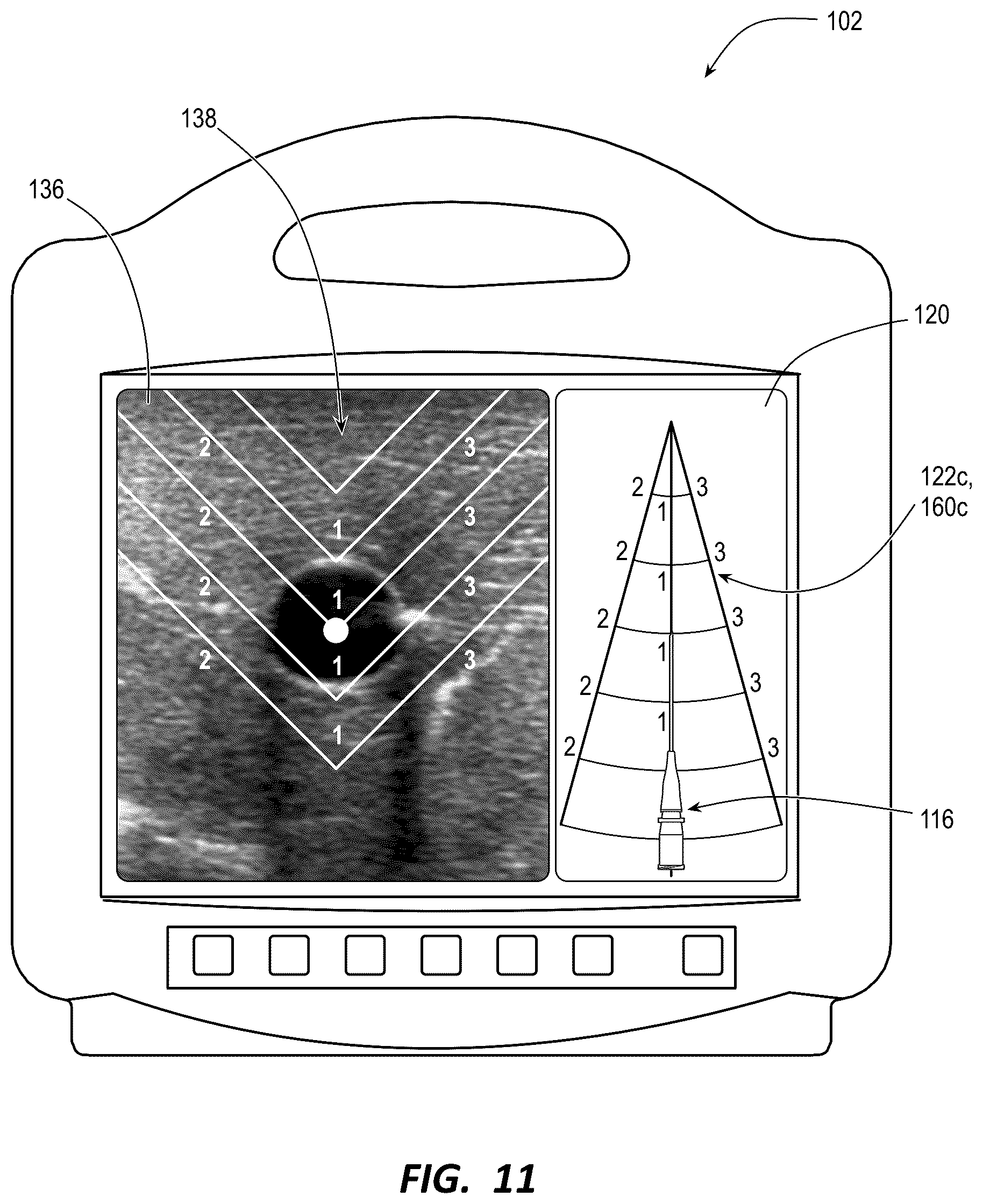 Patent US12137987 Figure 9 – Ultrasound systems and methods for sustained spatial attention