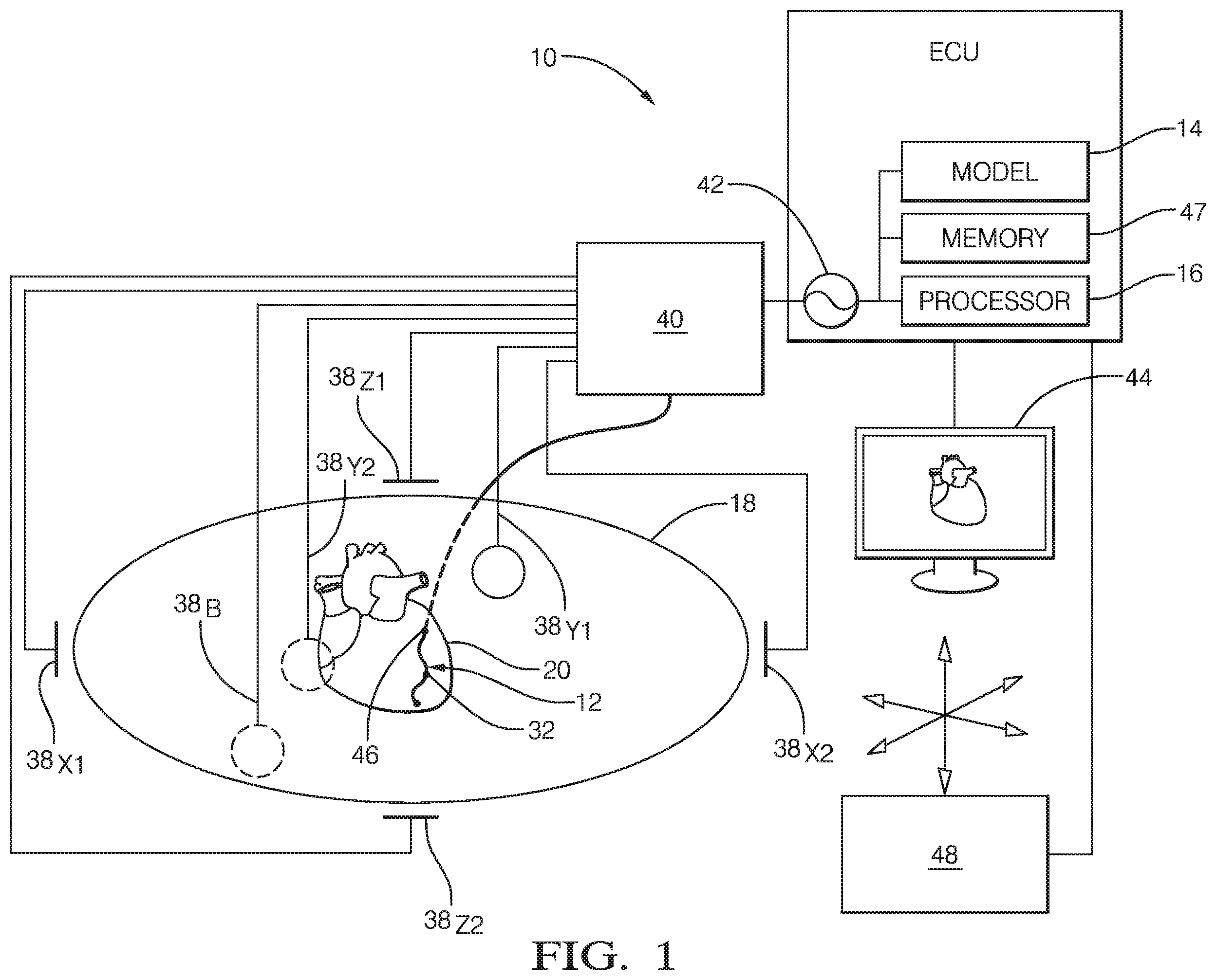 Patent US12137988 Figure 1 – System and method for noise tolerant cardiac localization, navigation and mapping