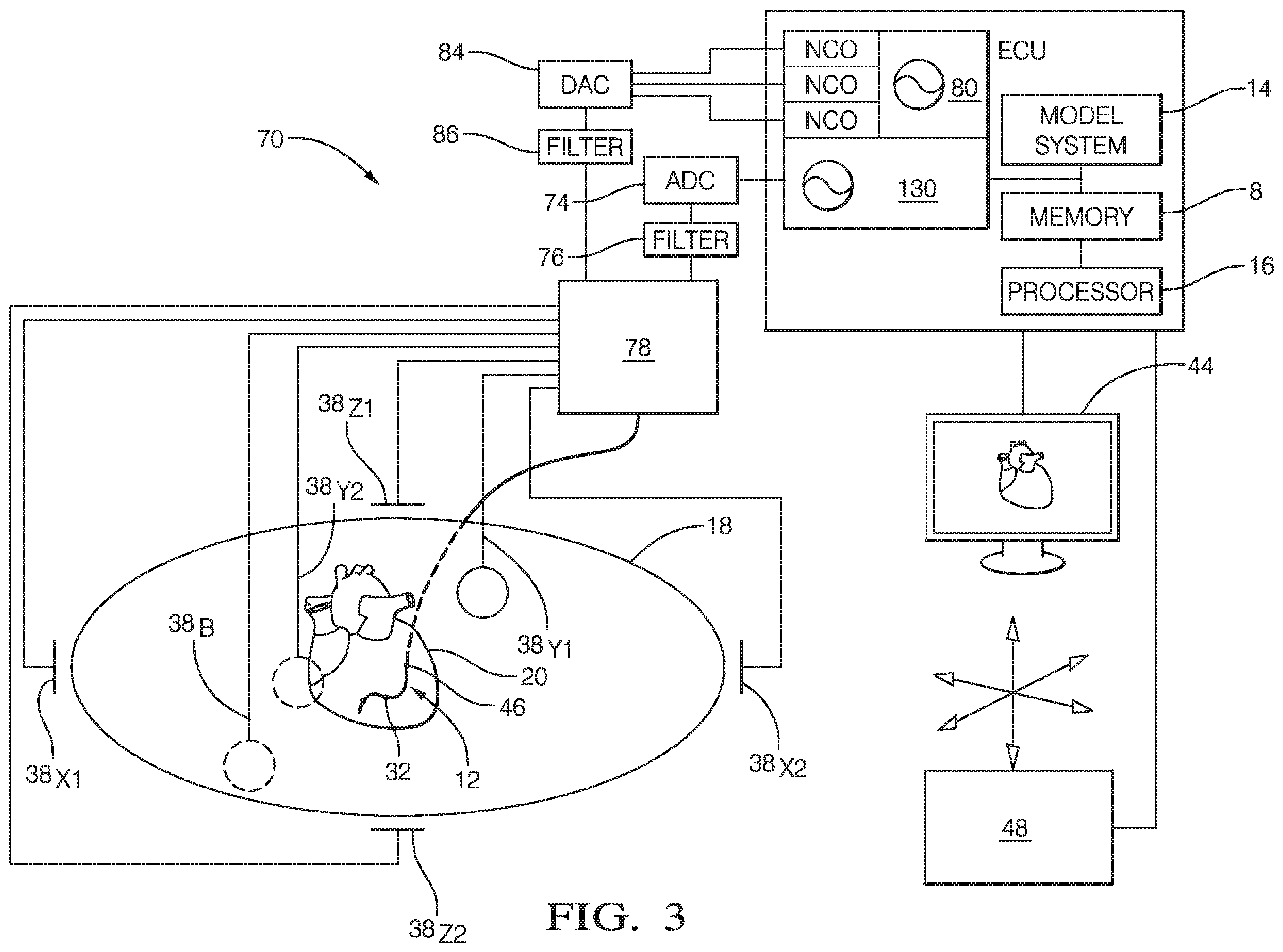 Patent US12137988 Figure 3 – System and method for noise tolerant cardiac localization, navigation and mapping