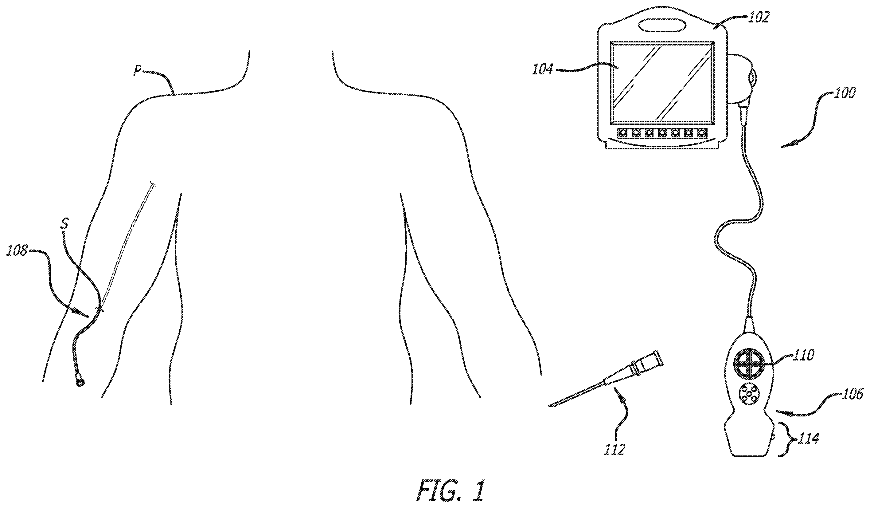 Patent US12137989 Figure 1 – Systems and methods for intelligent ultrasound probe guidance