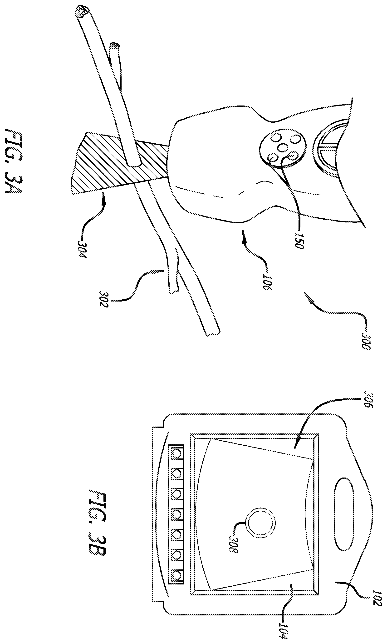 Patent US12137989 Figure 3 – Systems and methods for intelligent ultrasound probe guidance