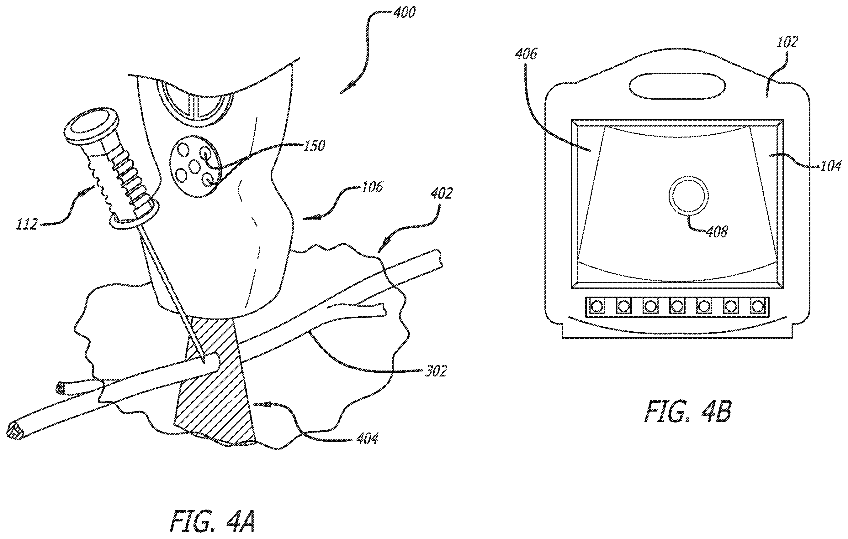 Patent US12137989 Figure 4 – Systems and methods for intelligent ultrasound probe guidance