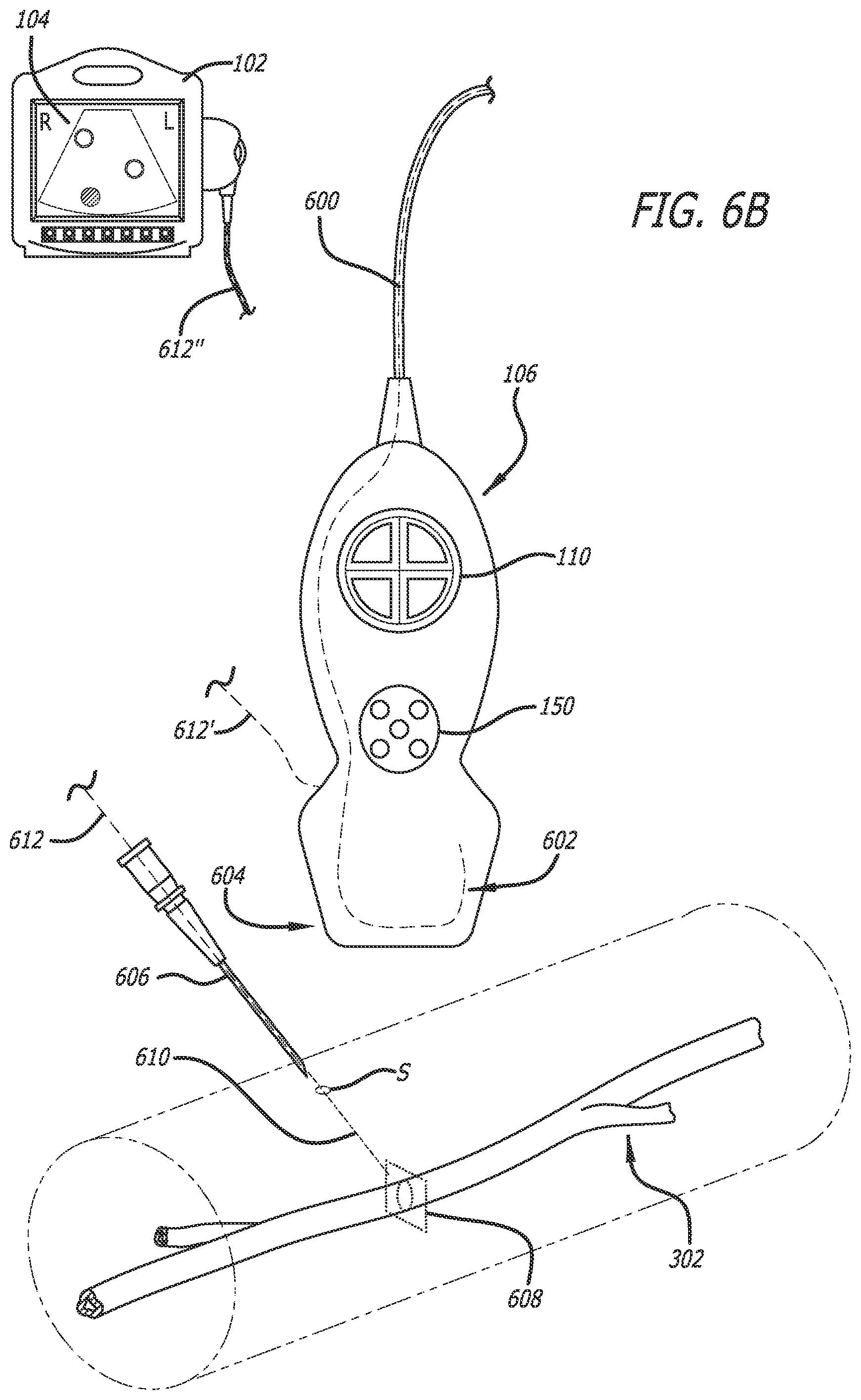 Patent US12137989 Figure 7 – Systems and methods for intelligent ultrasound probe guidance
