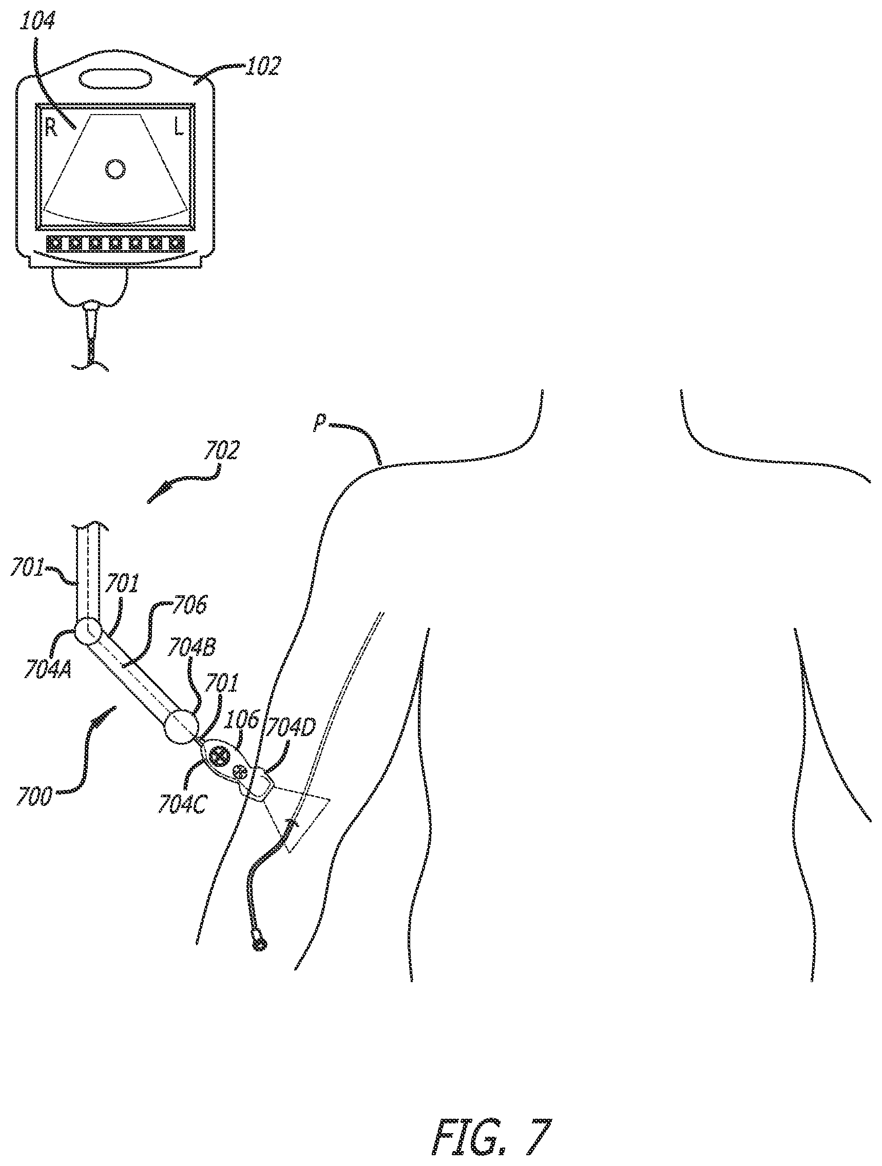 Patent US12137989 Figure 8 – Systems and methods for intelligent ultrasound probe guidance