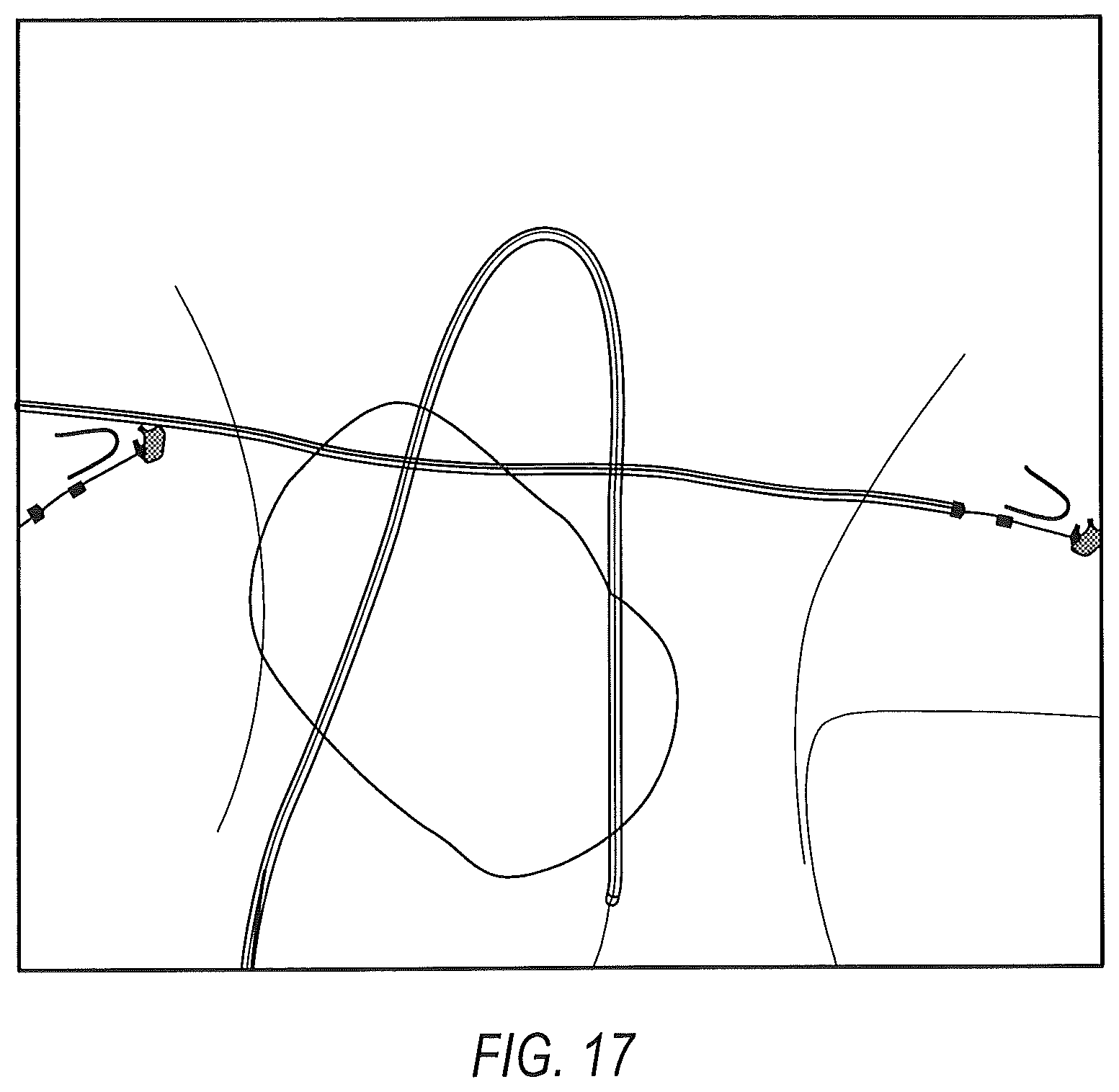 Patent US12137990 Figure 16 – Systems and methods for localizing, tracking and/or controlling medical instruments